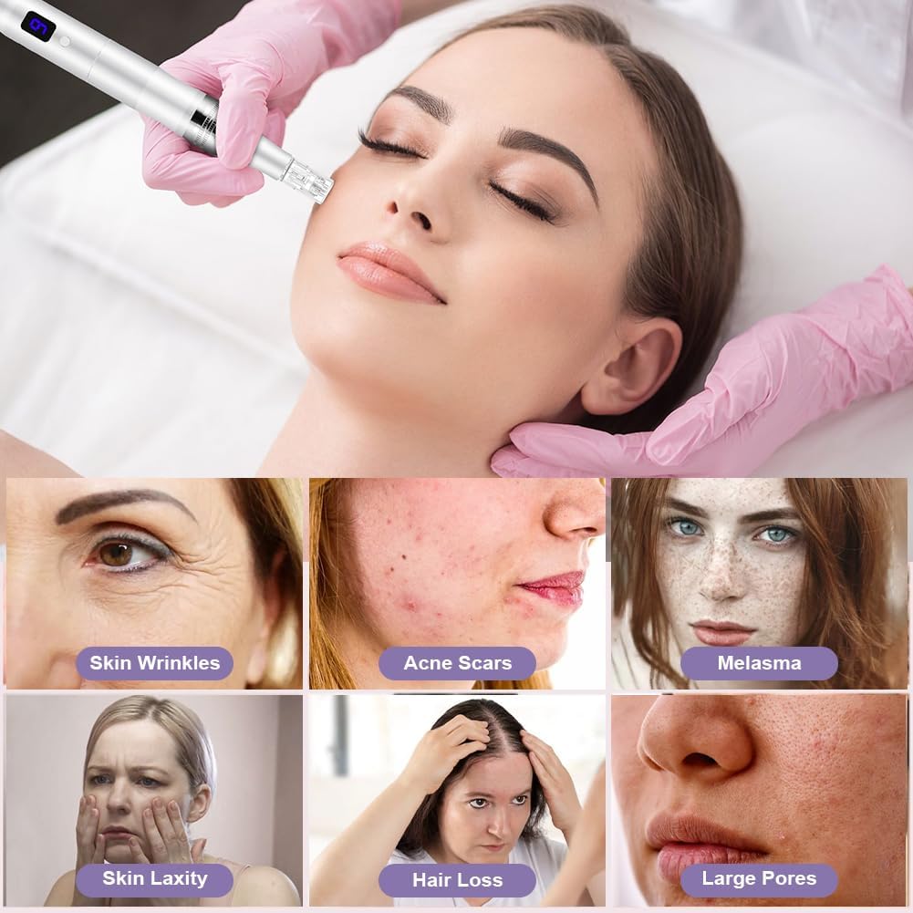 Thumbnail 3 de Vicloon Dermapen Elettrico per Microneedling Professionale con Display LCD, 6 livelli e 12 cartucce sigillate