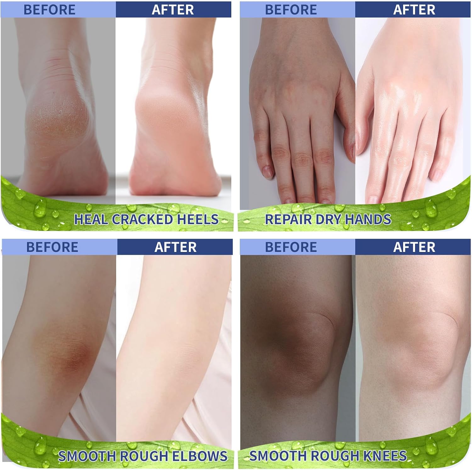 Detalle de Yegfit Urea Foot Cream, 200 mL