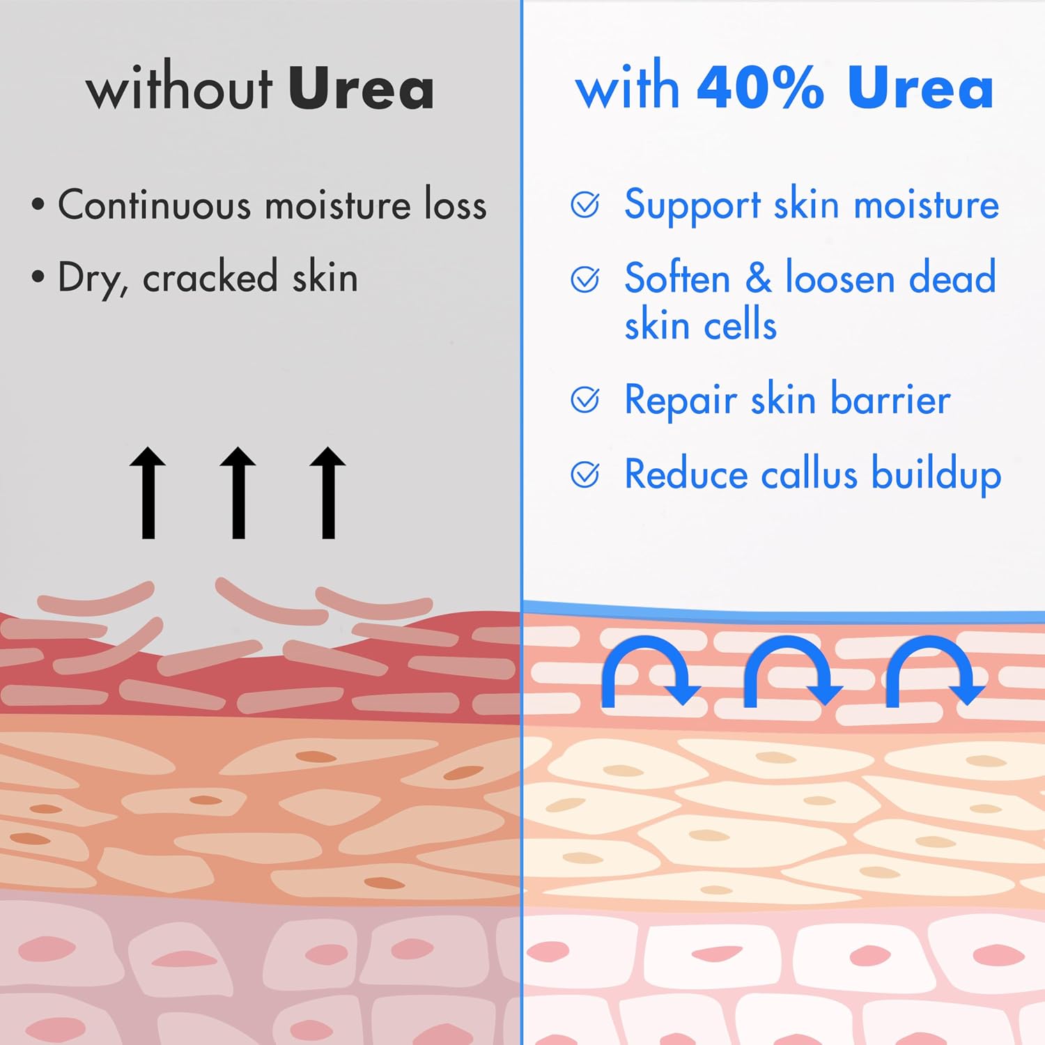 Thumbnail 4 de Ebanel Urea Cream 40% Foot Treatment 🦶