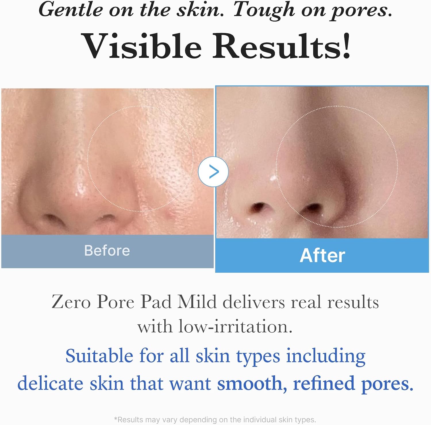 Thumbnail 4 de medicube Zero Pore Pad Mild 2.0