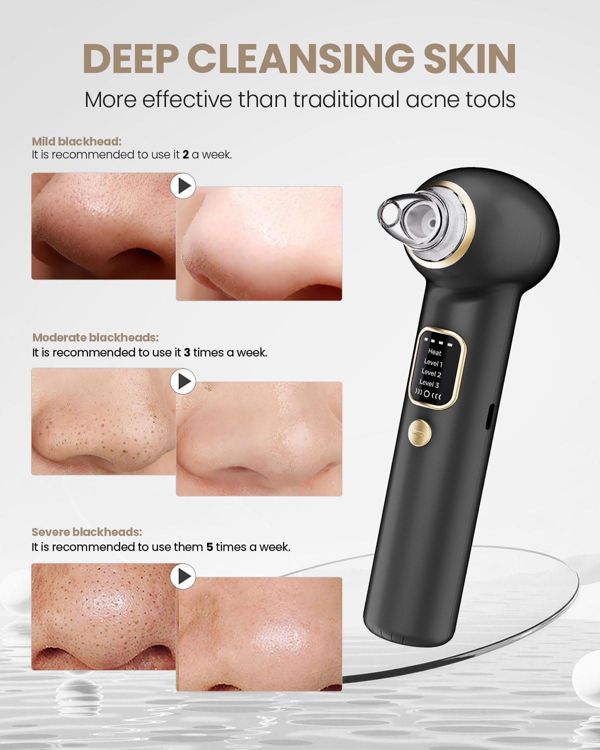 Thumbnail 2 de Heated Blackhead Remover with 5 Probes