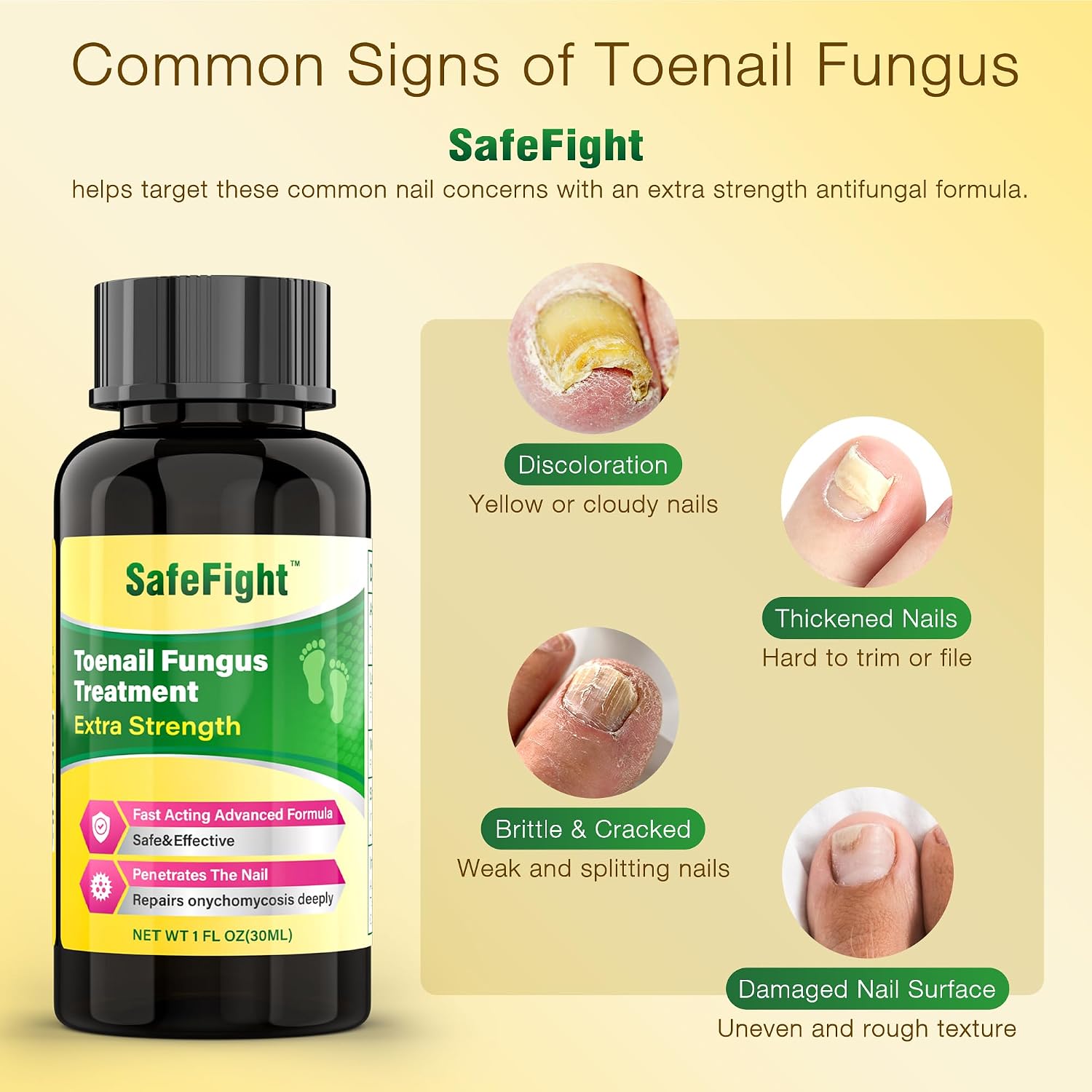Detalle de SafeFight Toenail Fungus Treatment 30 mL