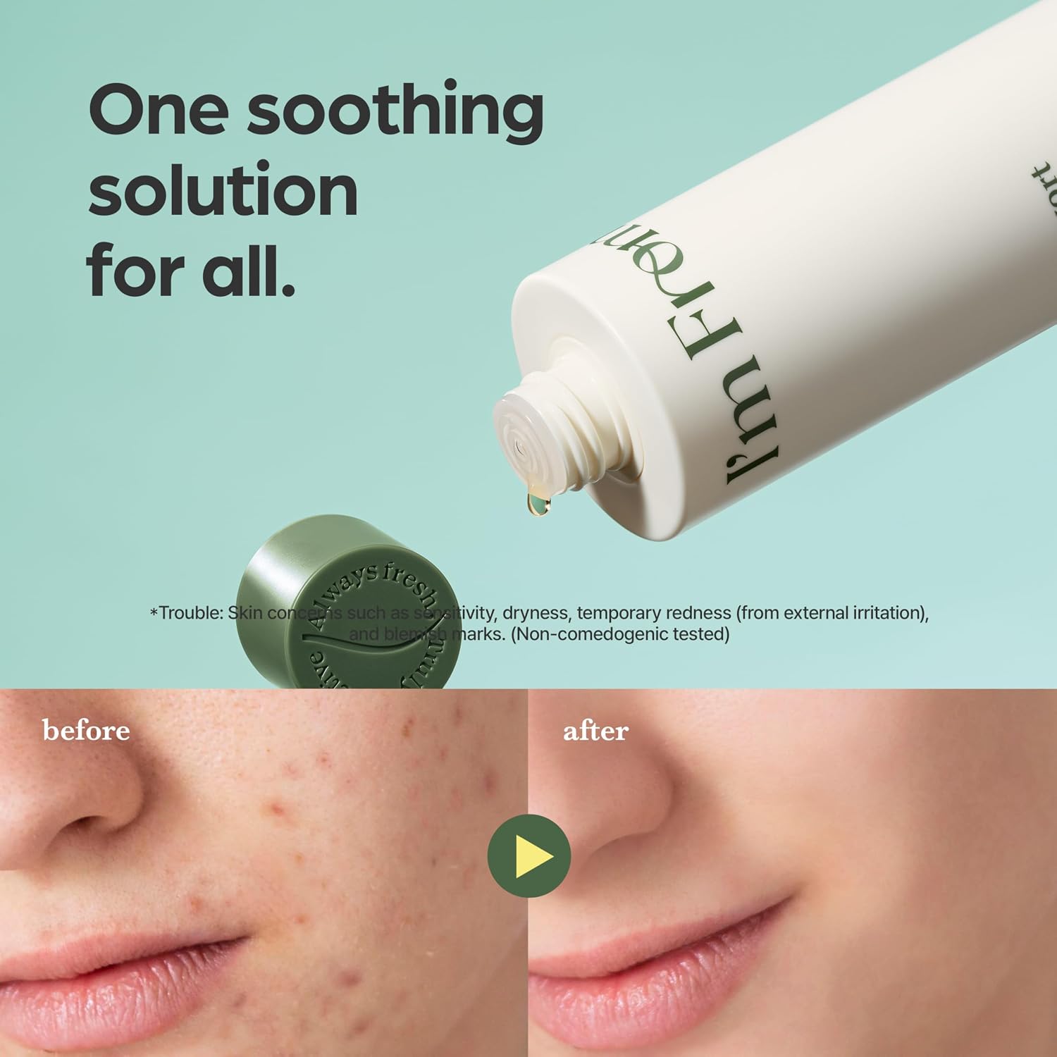 Thumbnail 3 de I’m From Mugwort Essence: Deep Calming Hydration for Sensitive Skin