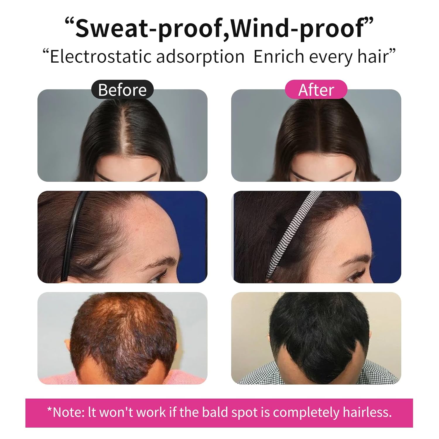 Detalle 2 de Haarfasern für Haaraufbau, 100 g dunkelbraun