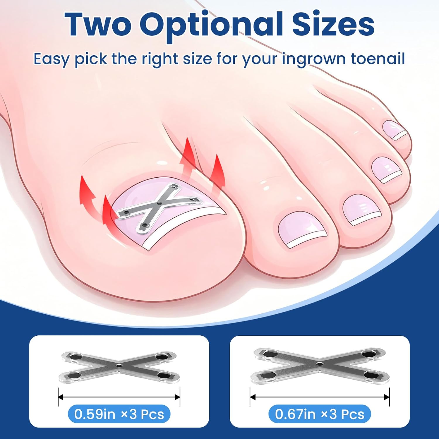 Thumbnail 4 de Ingrown Toenail Corrector, Titanium Alloy