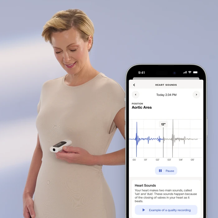 Thumbnail 9 de Withings BeamO Herzgesundheit und Temperatur