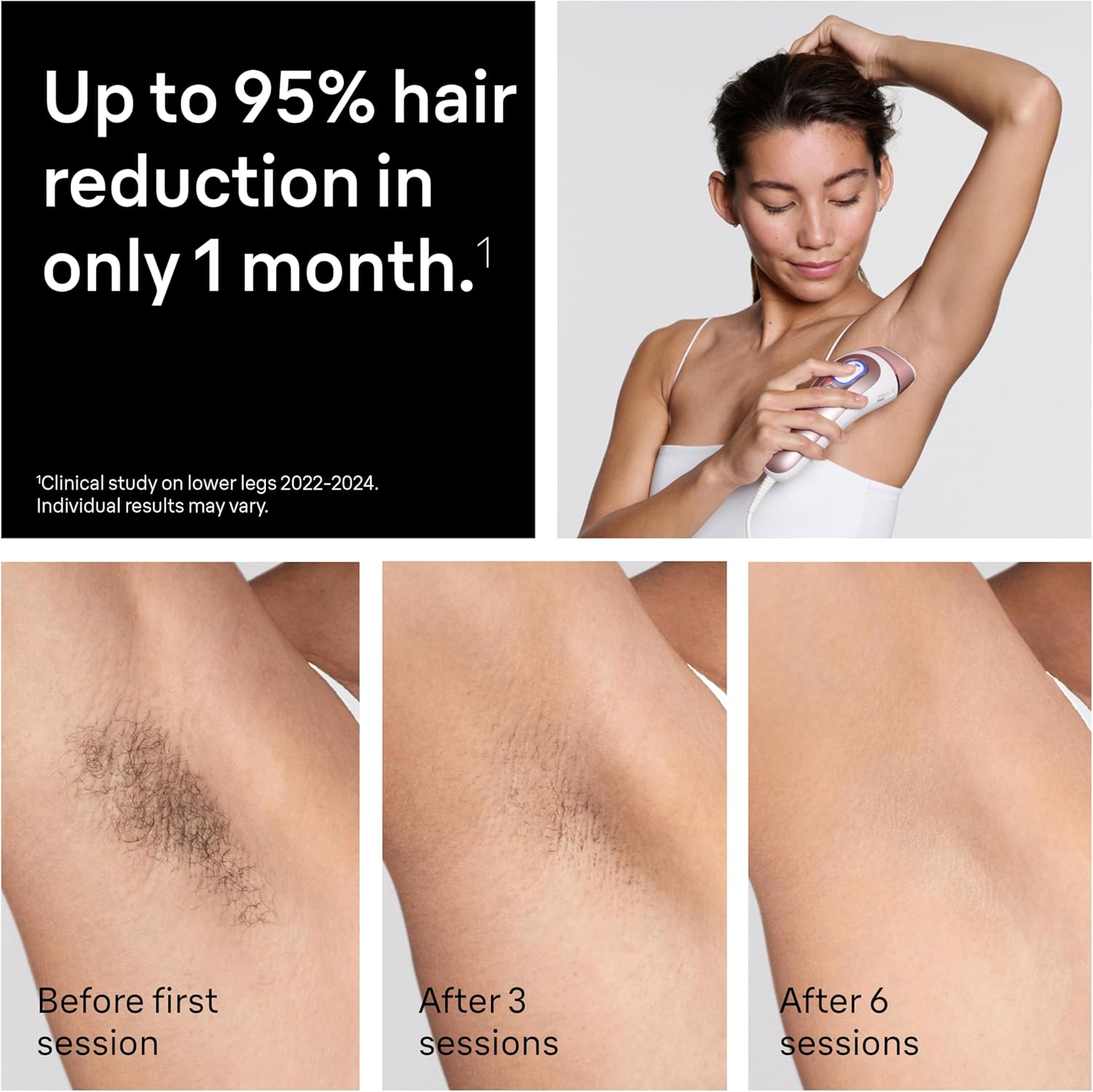 Detalle de Braun Smart IPL Pro 7 2-year