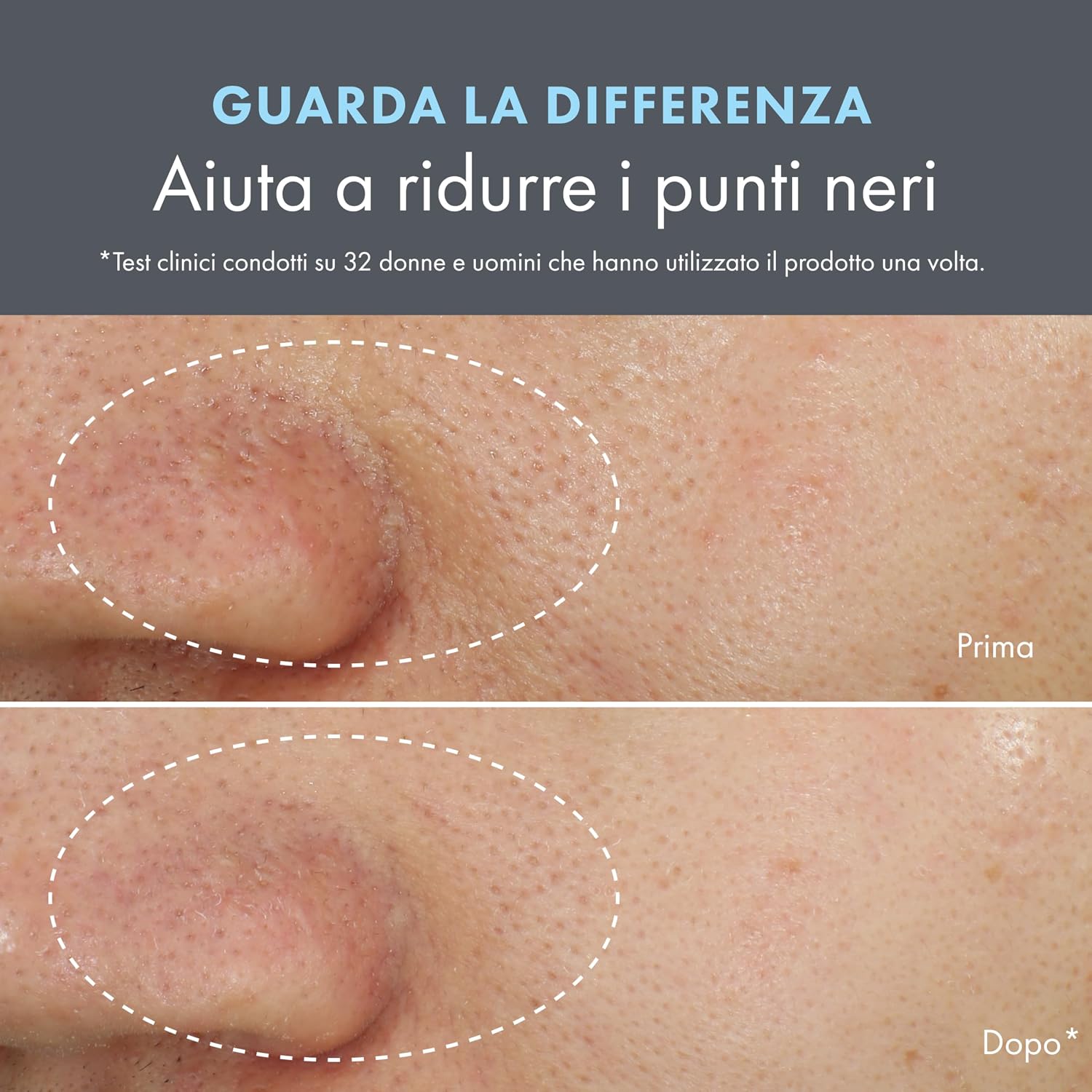 Detalle 2 de Origins Clear Improvement Blackhead Clearing Face Mask & Scrub – Maschera viso con Acido Salicilico e Carbone di Bambù, 75 ml