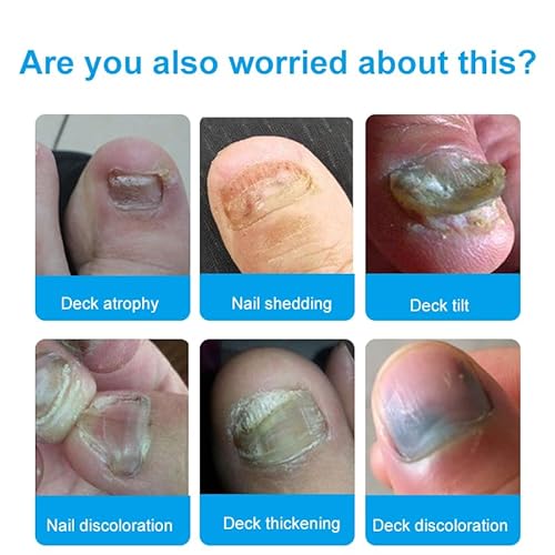 Detalle de AECECI Fungal Nail Liquid 30ml