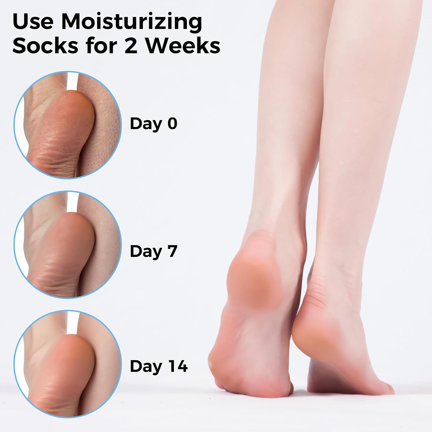 Thumbnail 4 de 5 Pairs Moisturising Socks for Dry Feet