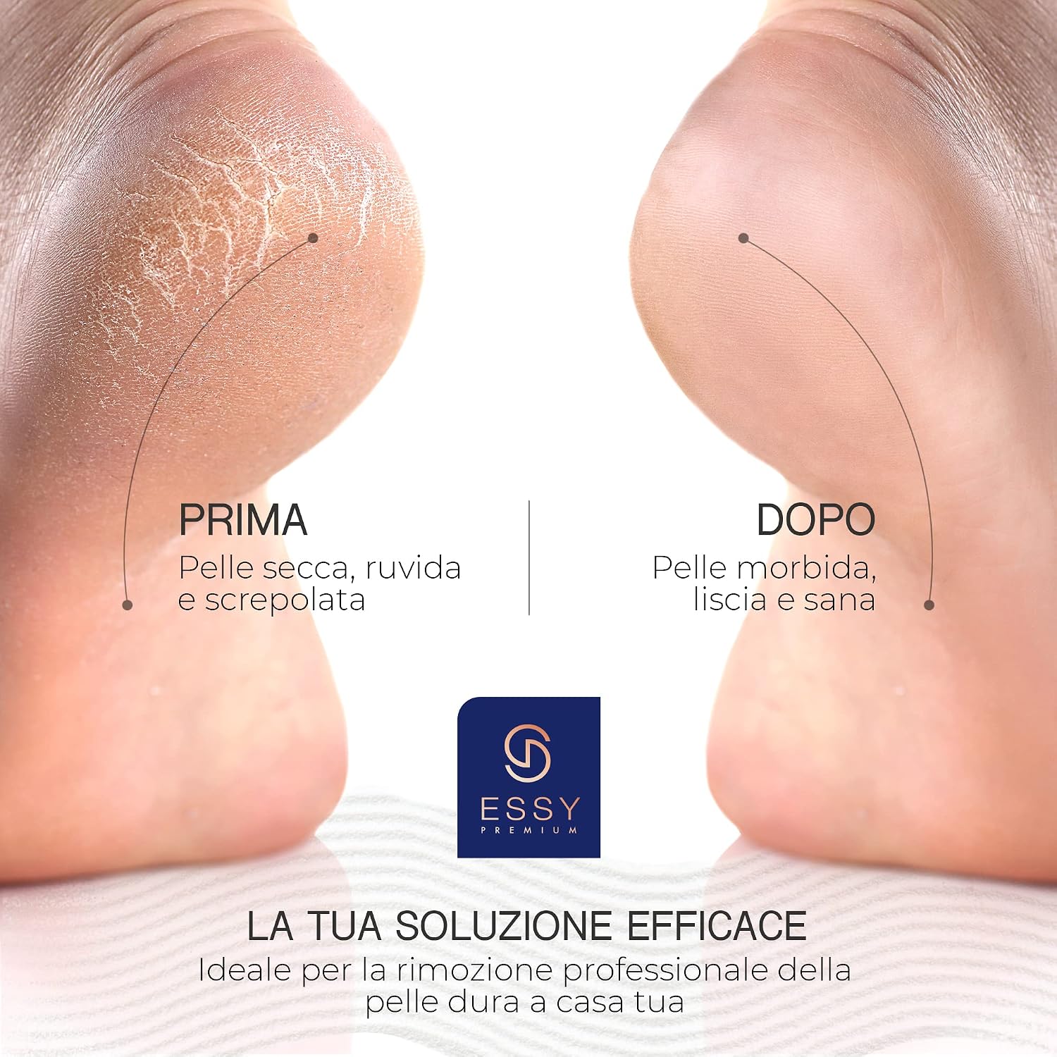 Thumbnail 4 de Essy Lima elettrica per pedicure con 5 rulli sostituibili per calli e duroni (Marina)