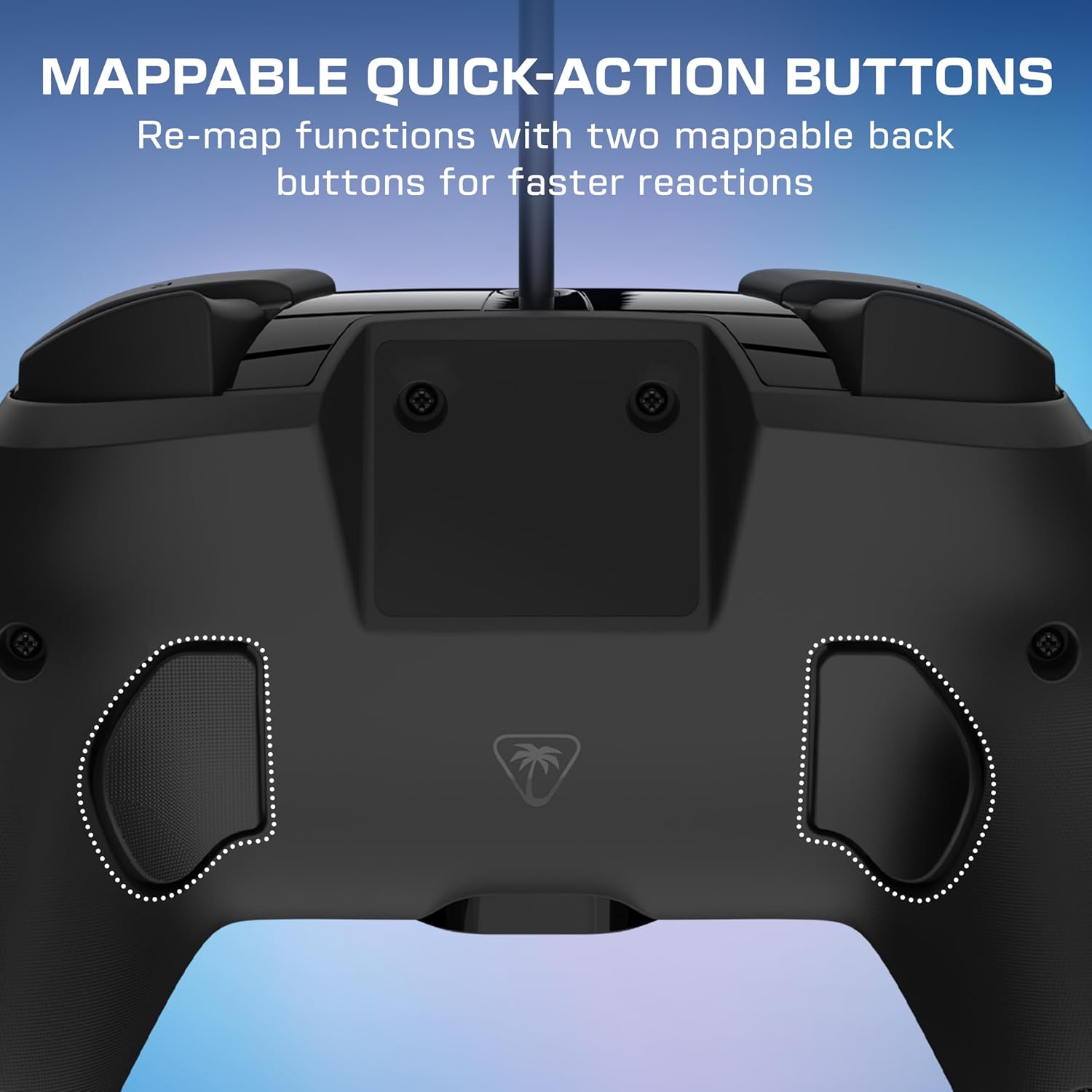 Detalle de Turtle Beach Rematch – kabelgebundener RGB-Gaming-Controller, offiziell lizenziert für Nintendo Switch