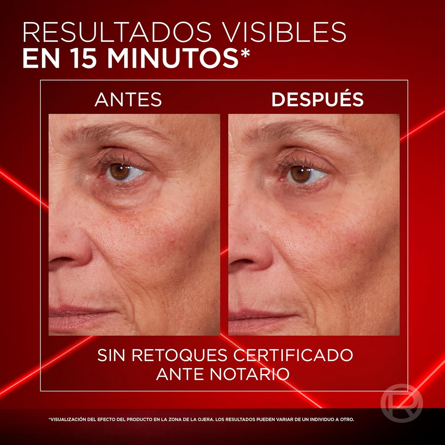 Thumbnail 2 de L'Oréal Paris Revitalift Laser Borrador de Bolsas Instantáneo. Deshincha y Alisa Bolsa de los Ojos en 15 minutos*. Corrector de Ojos. Mirada Firme y Rejuvenecida. Contorno de Ojos Hombre y Mujer.15ml