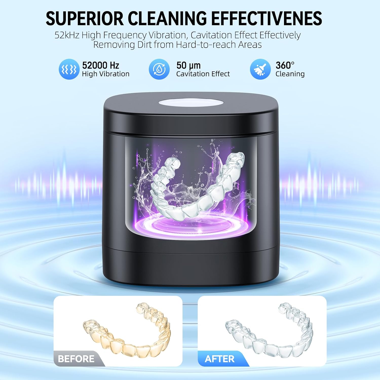 Detalle de COBEEK Ultrasonic Retainer Cleaner Machine, 52kHz 250ml Capacity — Deep Cleaning for Retainers, Braces, and More