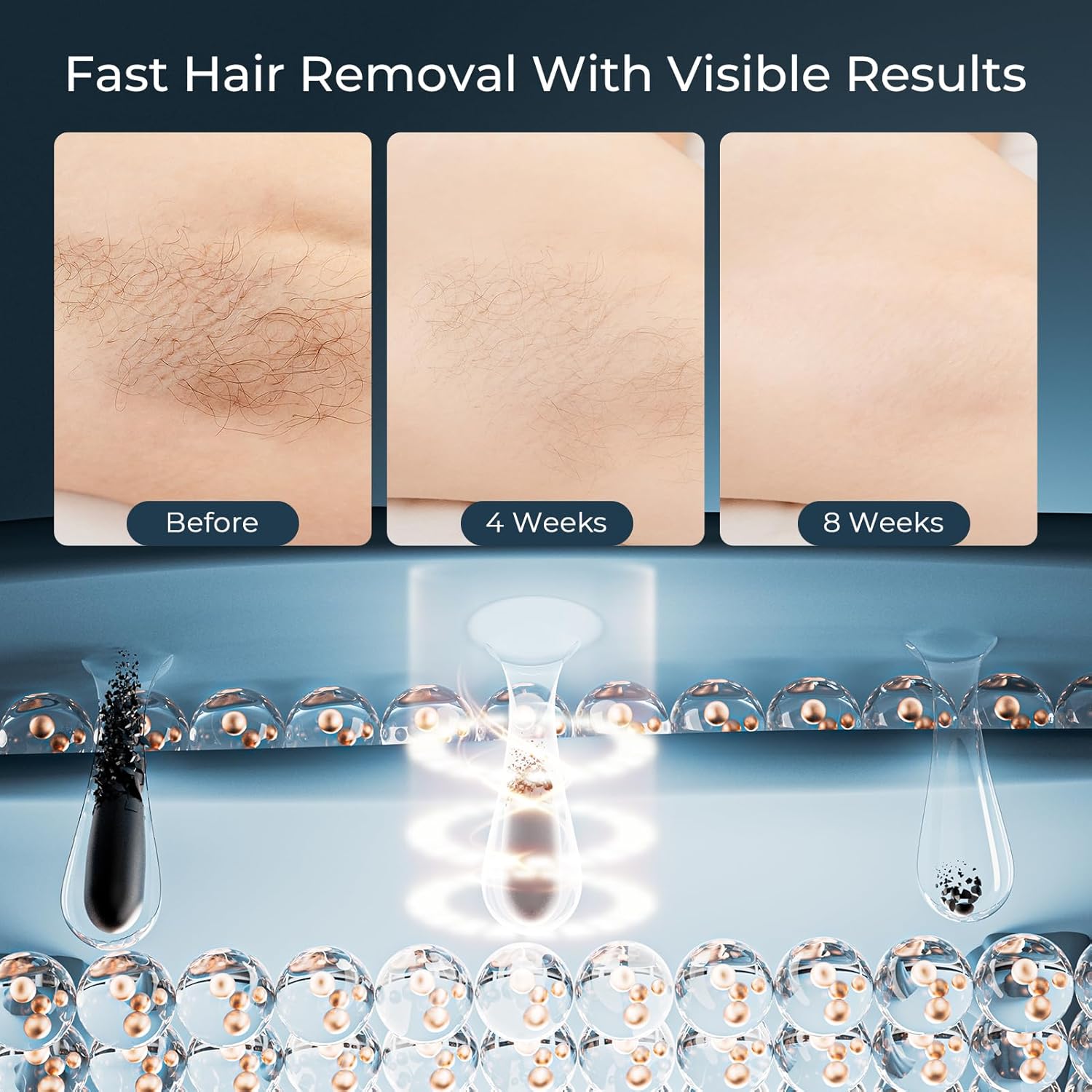 Detalle de 21J IPL Laser Hair Removal Device — 9 Energy Levels, 21J, at-home solution for face, bikini and body