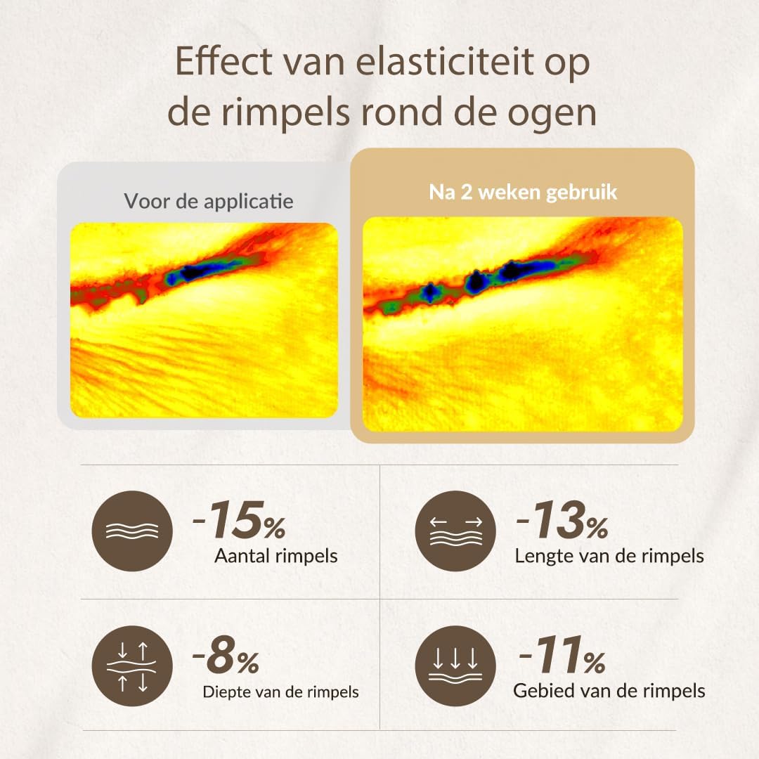 Thumbnail 4 de MIZON MZSNEC oogcrème met 80% slakkenslijmfiltraat, 25 ml