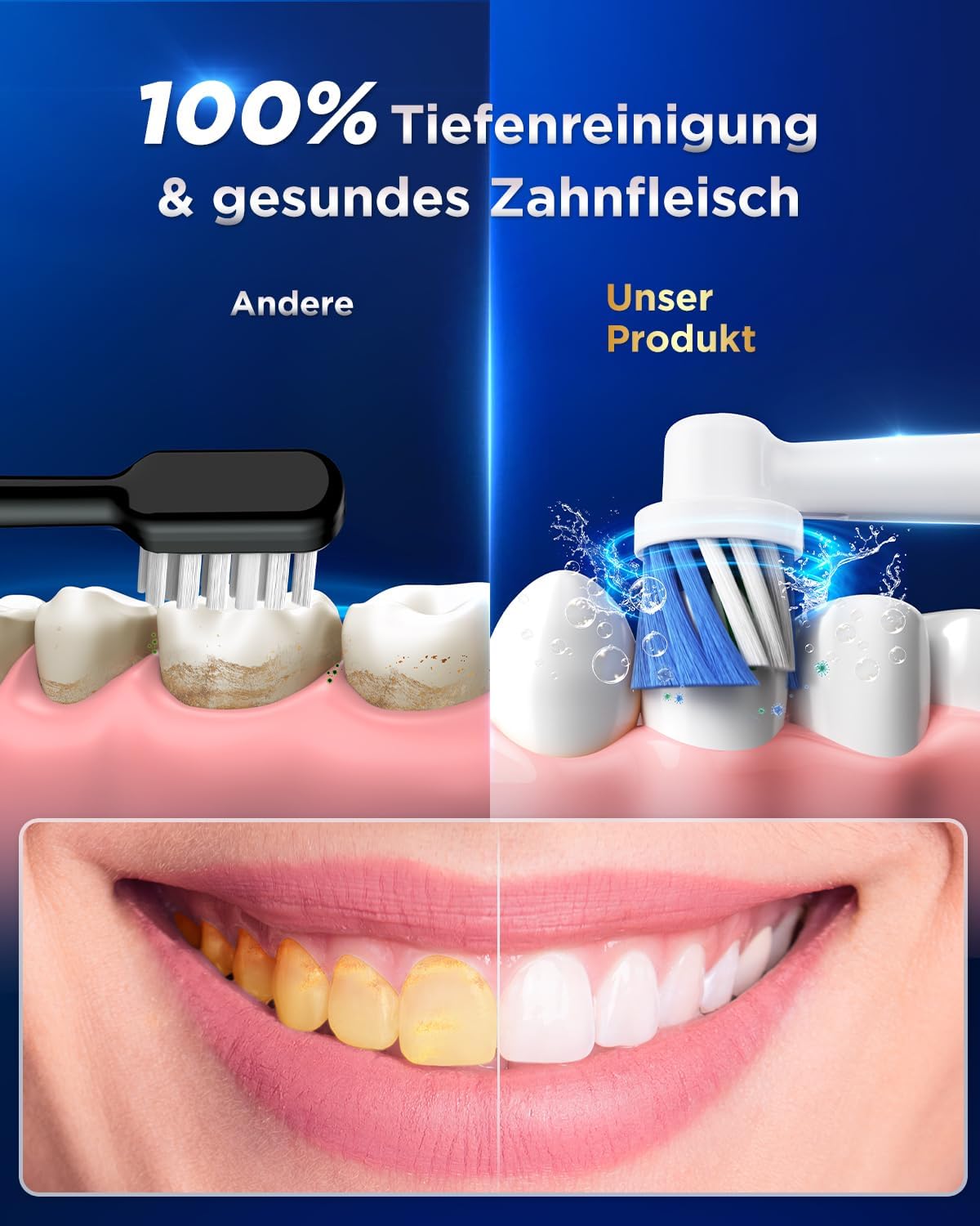 Detalle de Elektrische Zahnbürsten – Rotierende Bürsten für Erwachsene und Kinder mit 8 Aufsteckbürsten, 3 Intensitäten, 5 Modi und Wandhalterung (IPX7)