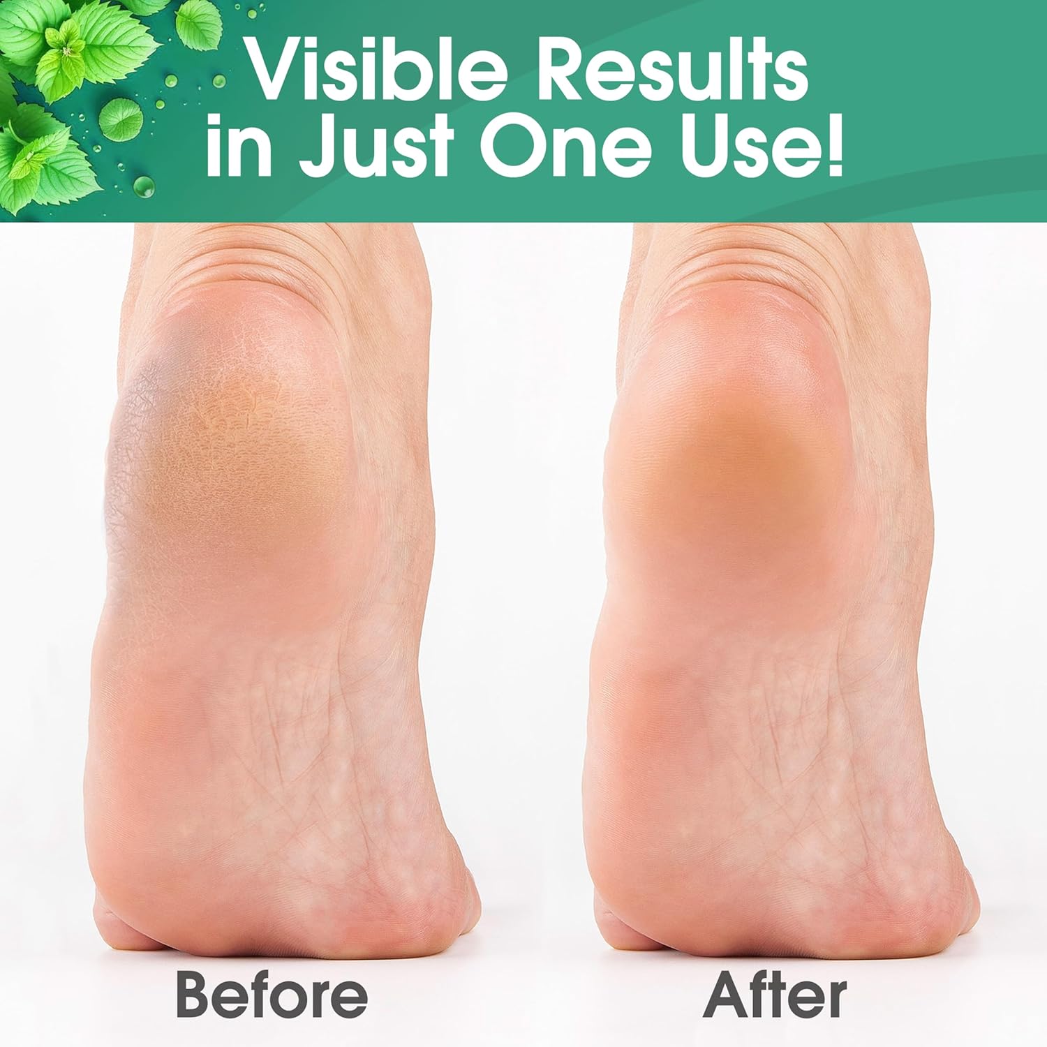 Thumbnail 2 de DeEnti Callus Remover for Feet, 8oz ⚙