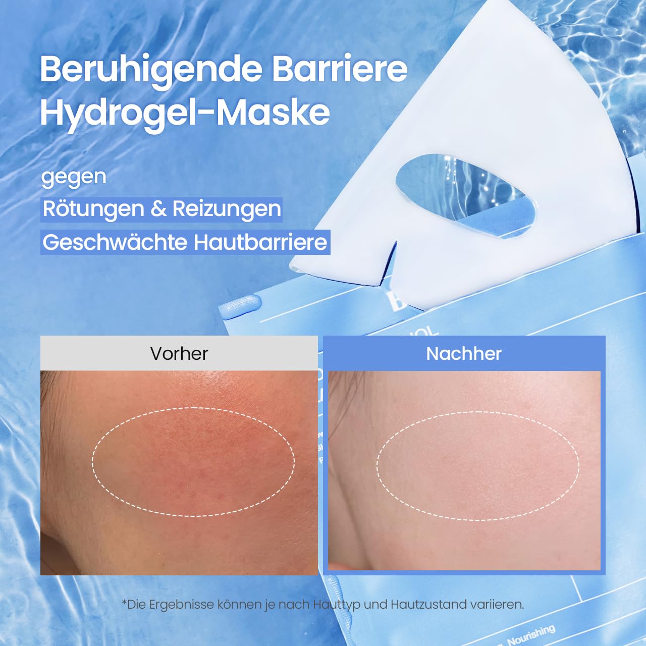 Detalle de BIODANCE Hydro Cera-nol Real Deep Maske – Overnight Hydrogel Maske, beruhigend und feuchtigkeitsspendend (34 g × 4 St.)