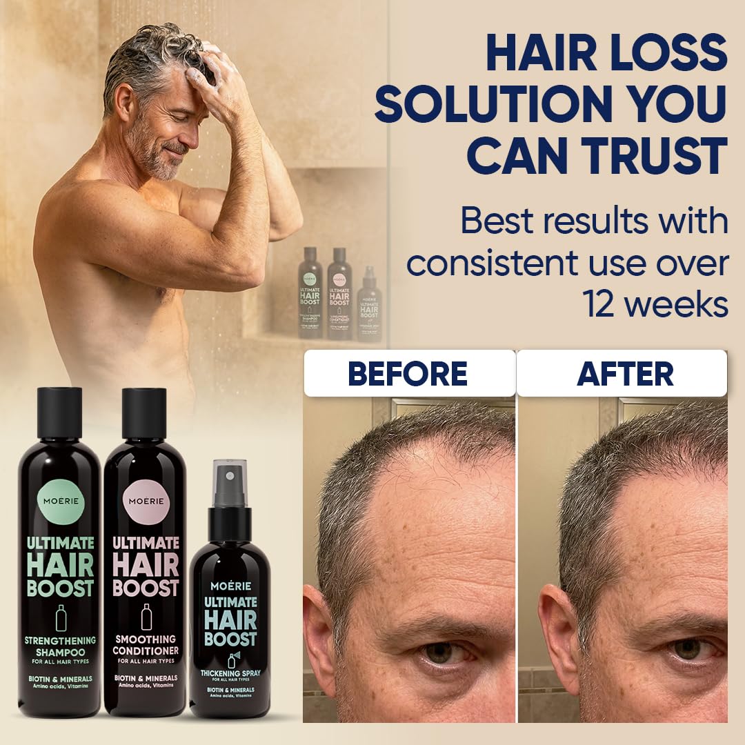 Thumbnail 3 de MOERIE Shampoo Set – gegen Haarausfall, Conditioner, Haarwachstum Serum & Haarmaske (3er-Set) – vegan, 77 Mineralien