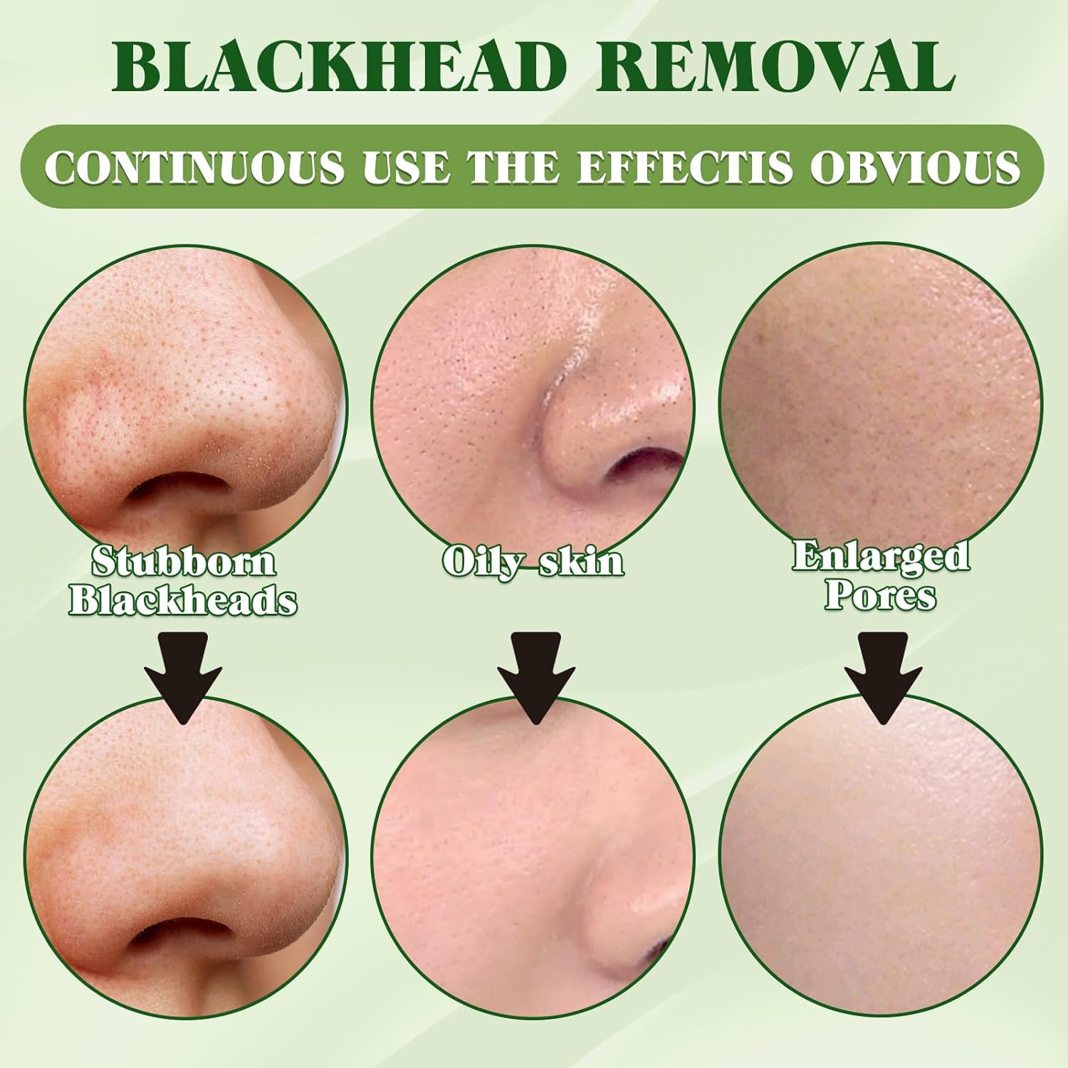 Thumbnail 2 de Eveellyn Mitesserentferner Stripes mit natürlicher Bambuskohle – Mitesserstreifen für Männer & Frauen (10 Stück)