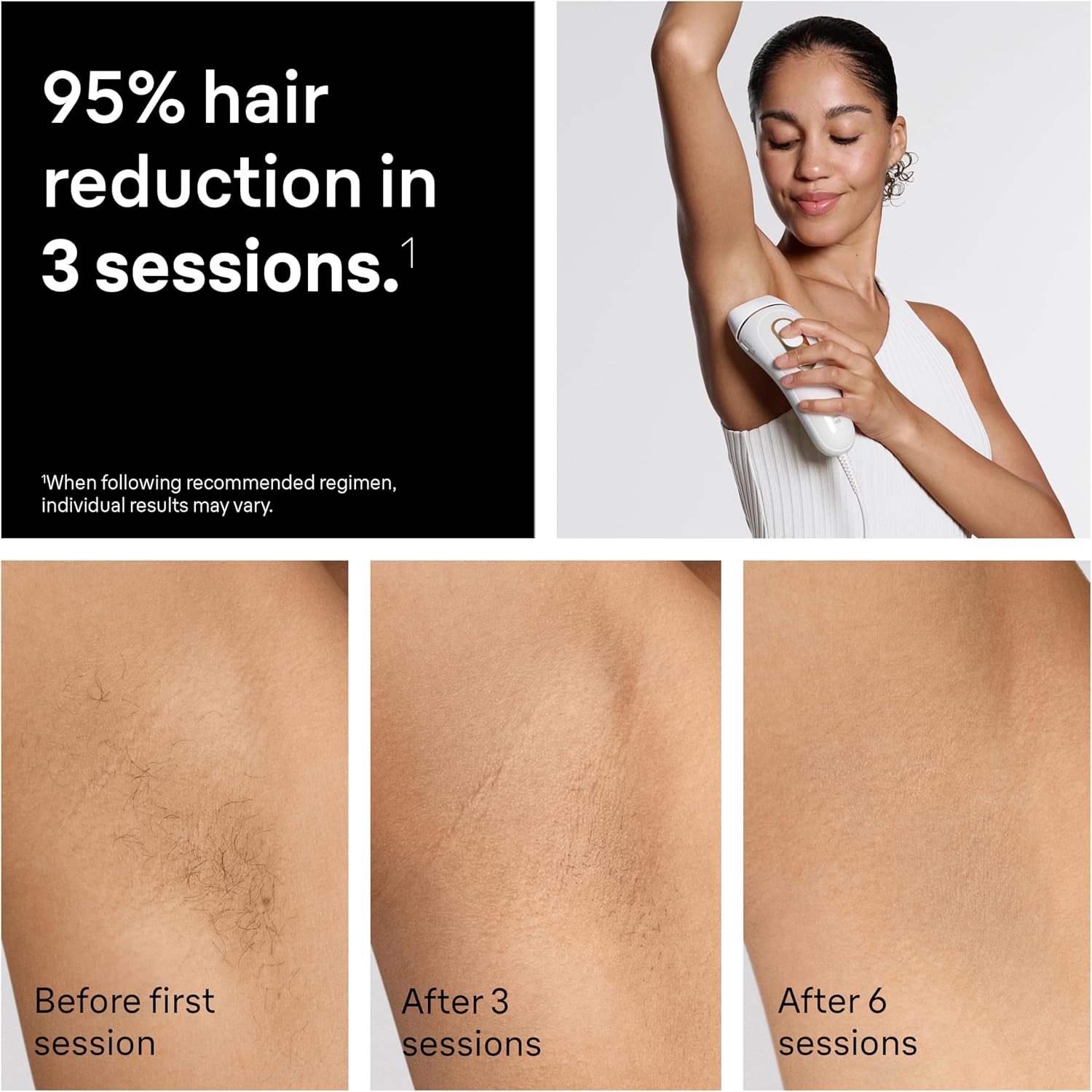 Thumbnail 3 de Braun Silk Expert Pro5 IPL PL5157 long-lasting at-home laser hair removal device with Venus razor