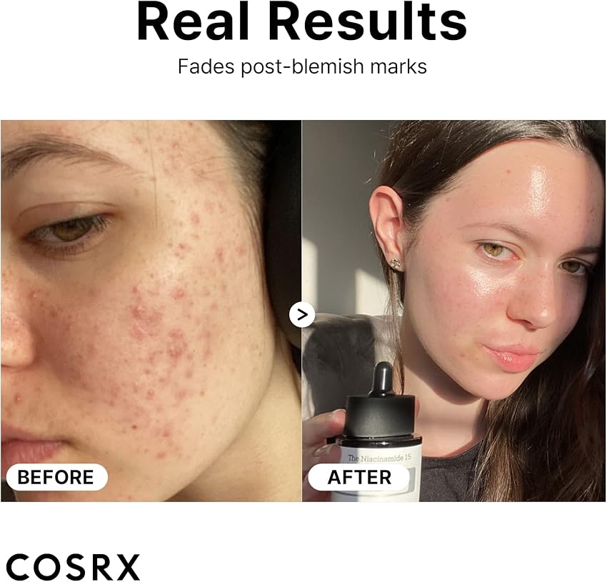 Thumbnail 5 de Cosrx The Niacinamide 15 Sérum