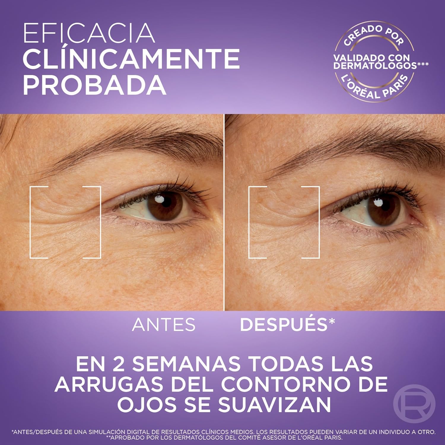 Thumbnail 4 de L’Oréal Paris Revitalift Filler Ojos