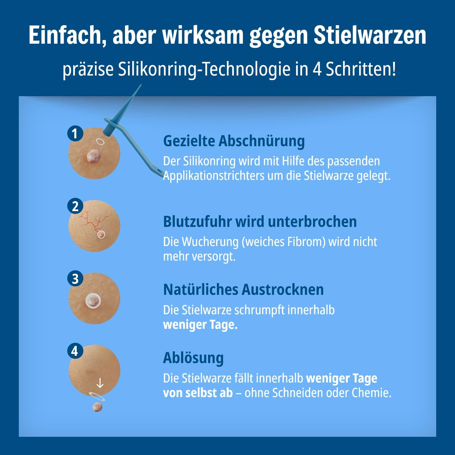 Detalle 2 de Evolsin Anti Stielwarzen Gel – natürliches Mittel gegen Stielwarzen