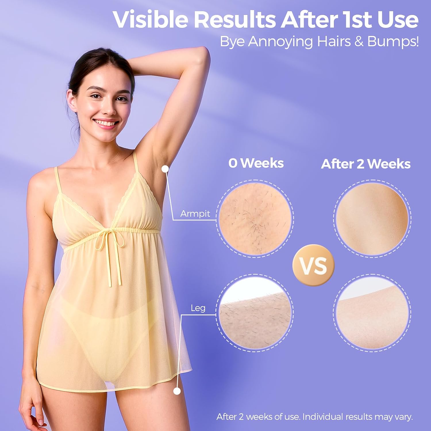 Thumbnail 2 de 2026 Upgraded Laser Hair Removal with 5°C Ice Cooling: At-Home IPL for Face & Body