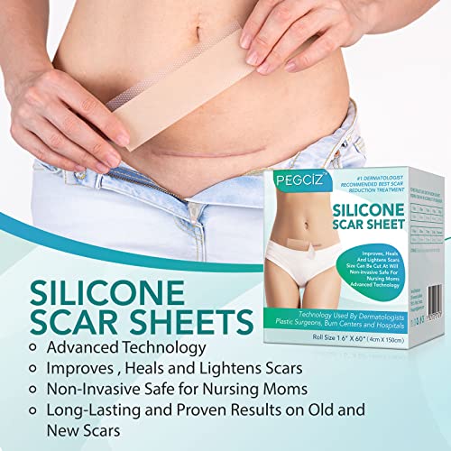 Detalle 2 de NVXNMSD Silicone Scar Sheets: Parches de Silicona para Cicatrices Verdes, 1.6'' x 60