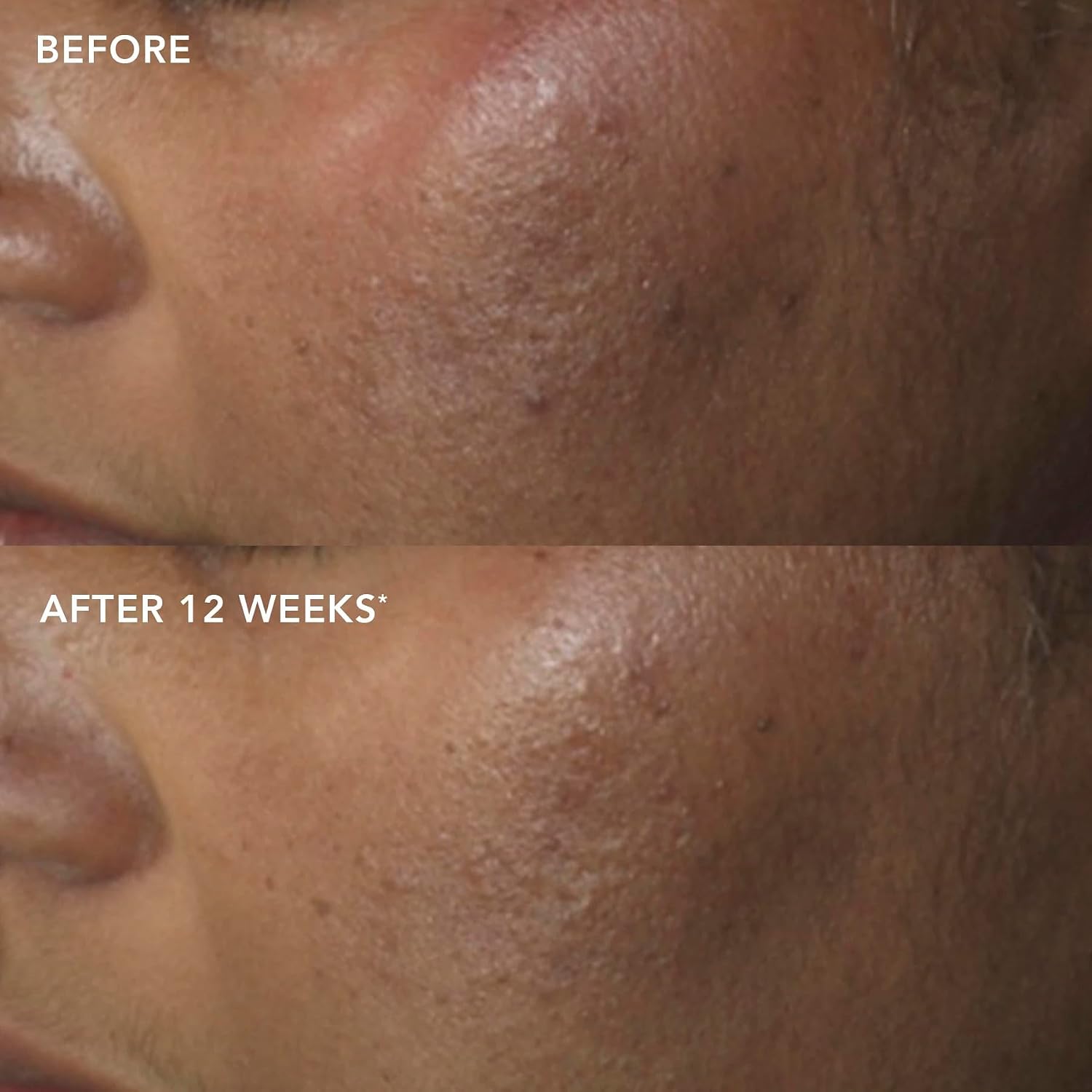 Thumbnail 6 de IMAGE Skincare MD Restoring Power‑C Serum 20% Vitamin C