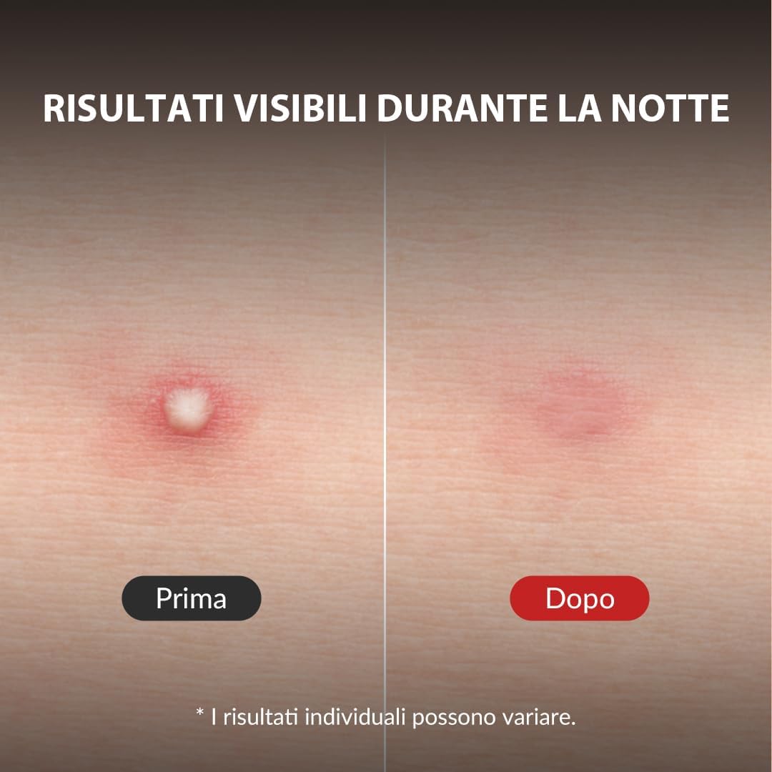 Thumbnail 3 de Mizon Good Bye Blemish Clear Patch 44 pezzi