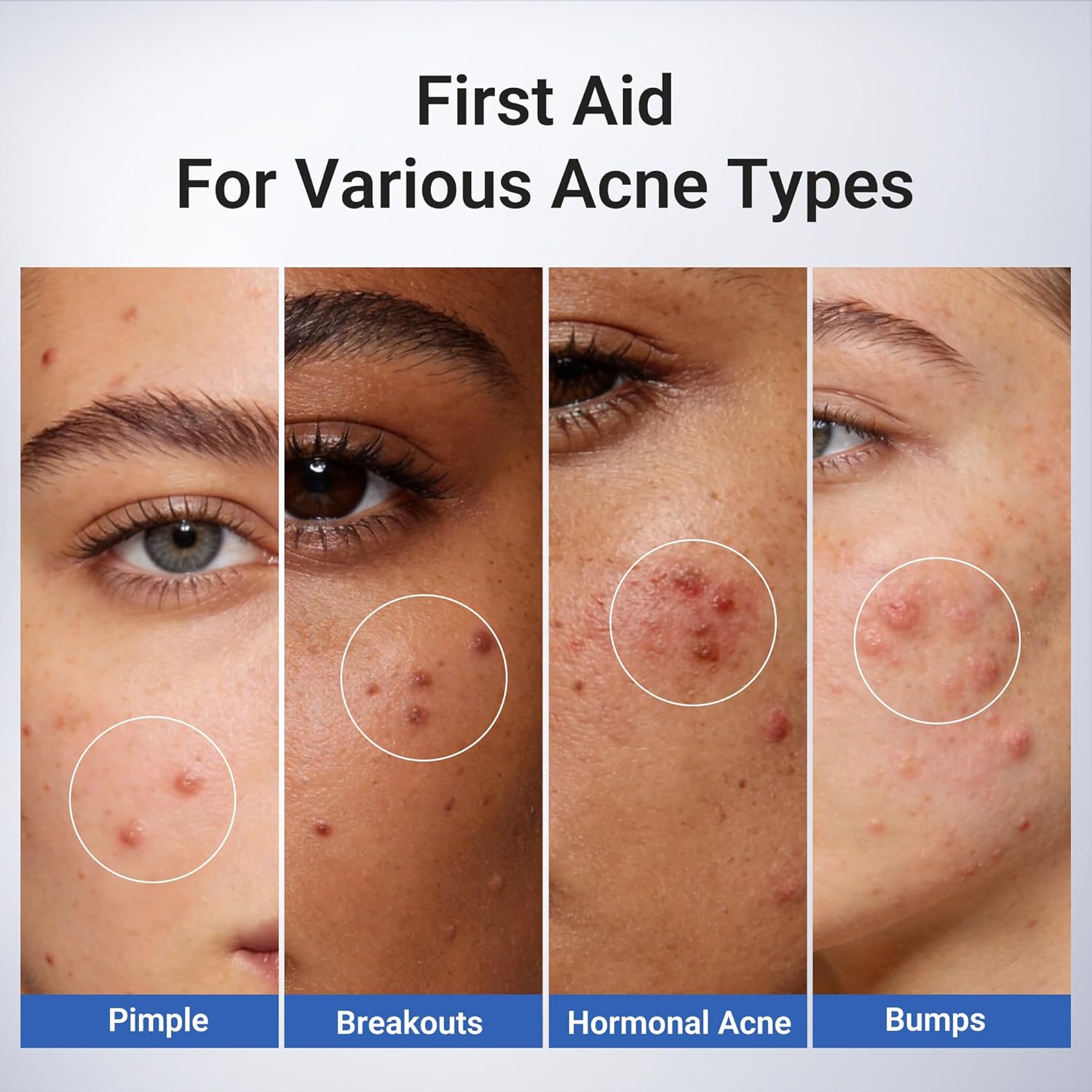 Detalle de Dr.Leo 1.8% Salicylic Acid Spot Serum (20 ml) for Acne-Prone Sensitive Skin