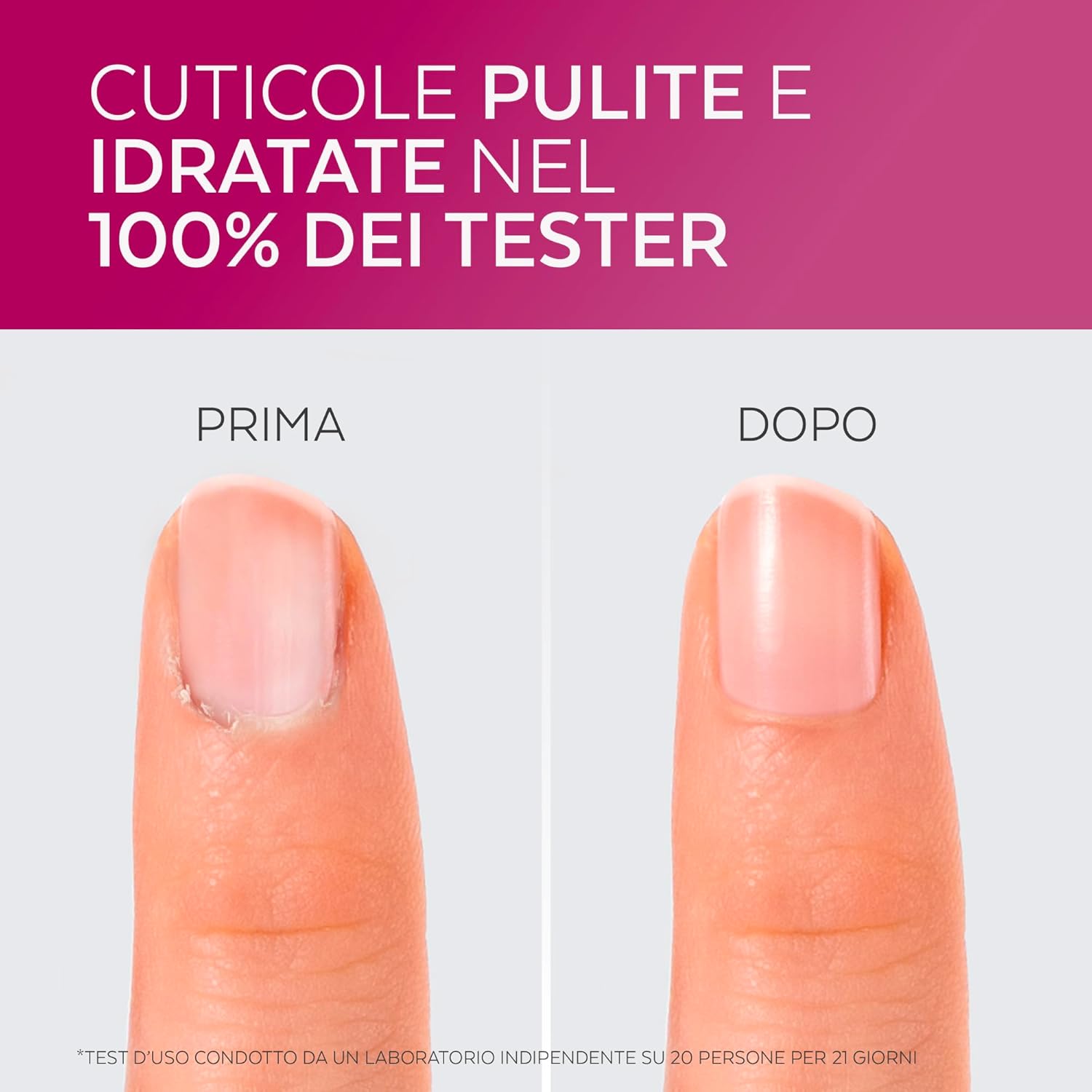 Thumbnail 2 de Poderm Cuticole Remover 2-in-1 30s ⏱