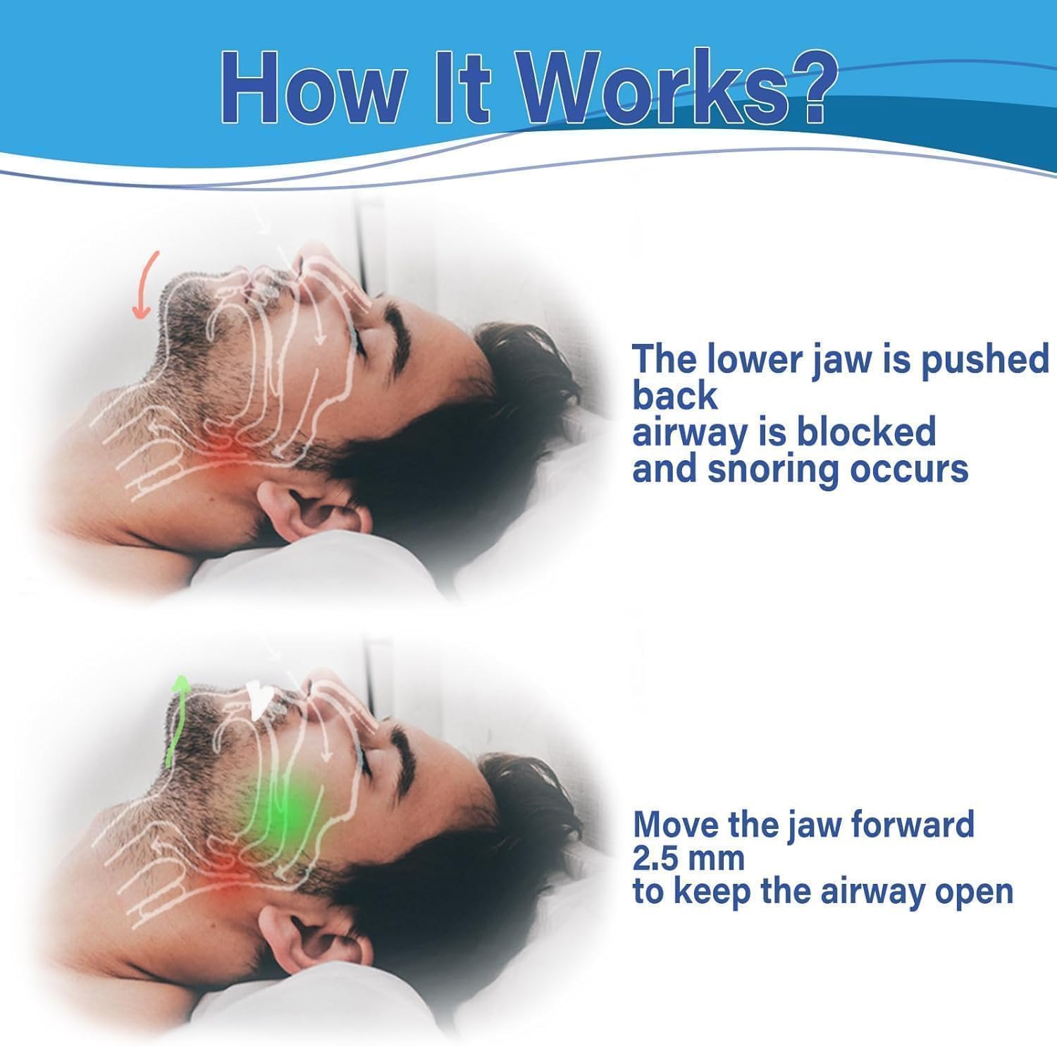 Detalle de AIOUTGOGO Anti Snoring Mouthpiece (180 open front design) — ready to use snore stopper