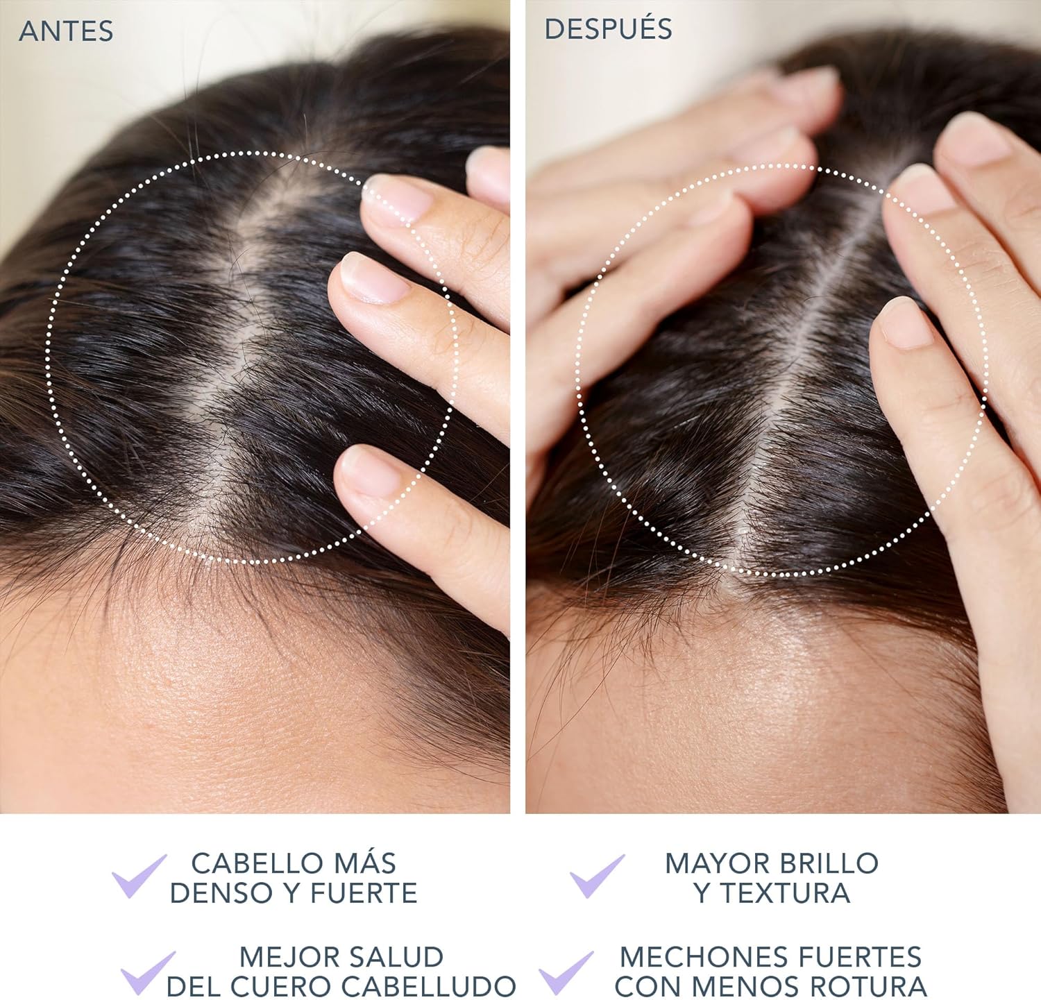 Thumbnail 4 de LUNA 4 Masajeador Eléctrico 2 en 1 para el Cabello