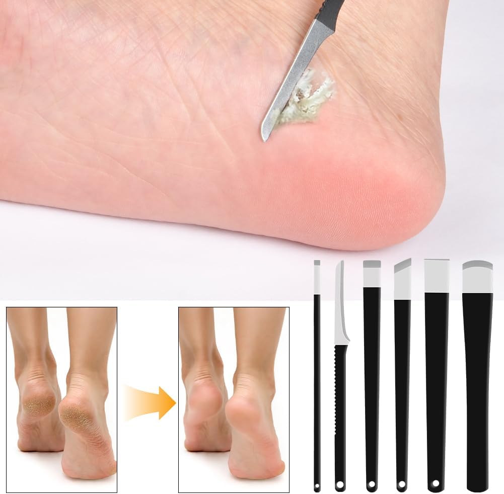 Thumbnail 4 de LOPHE Bisturi per pedicure set professionale 6 pezzi ✂