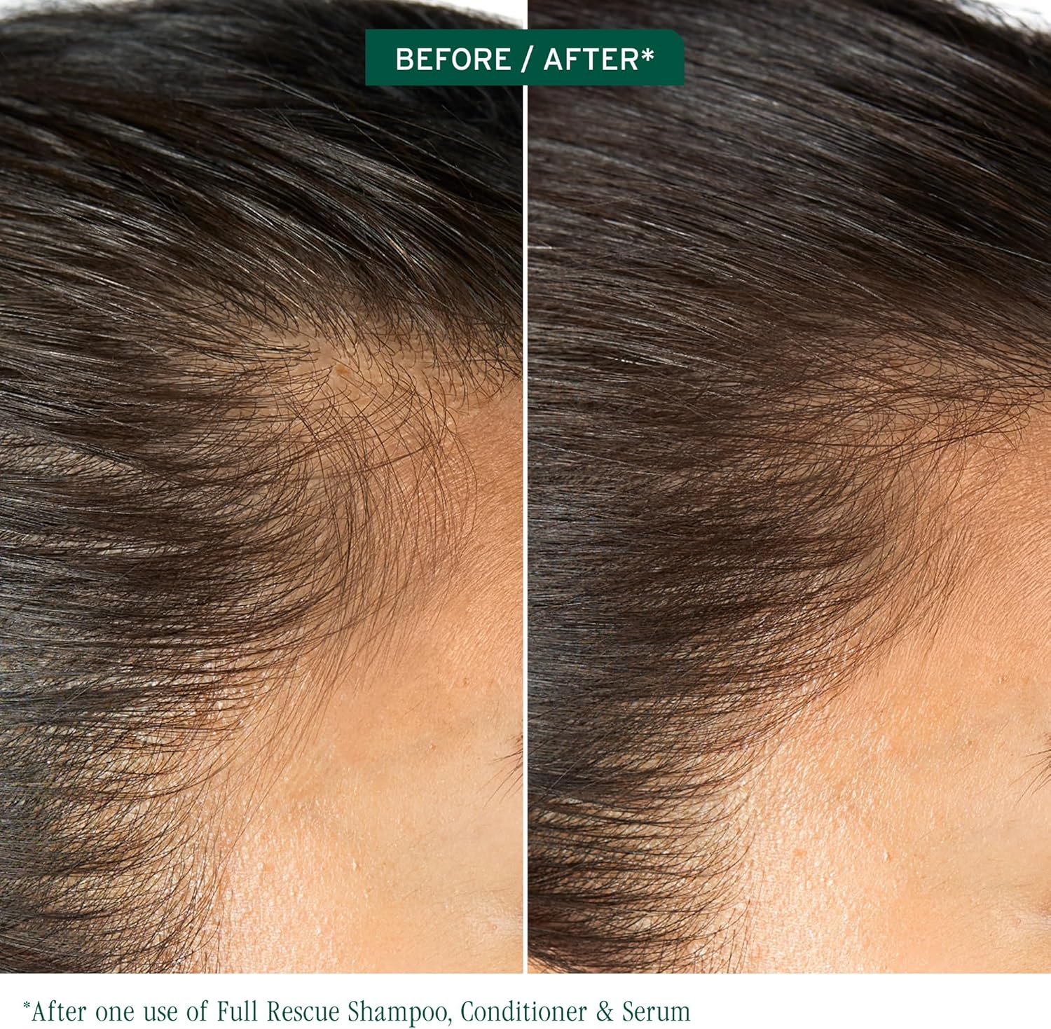 Detalle 2 de Biolage Full Rescue Invigorating Scalp Serum with Rosemary Oil & Niacinamide (50ml)