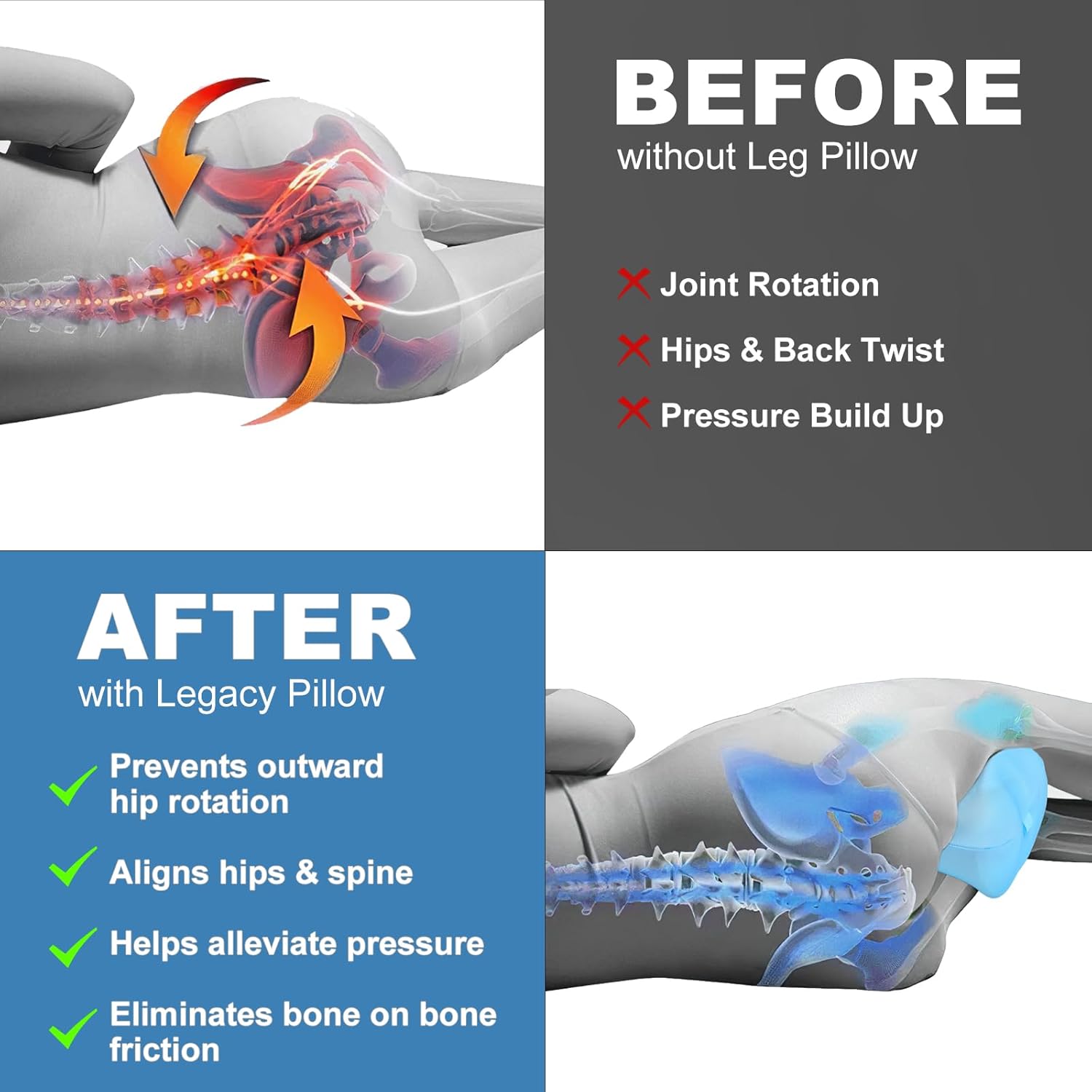 Thumbnail 3 de Hydomi Foot- & Leg-Rests Orthopaedic Knee Pillow for Side Sleepers with Cooling Cover