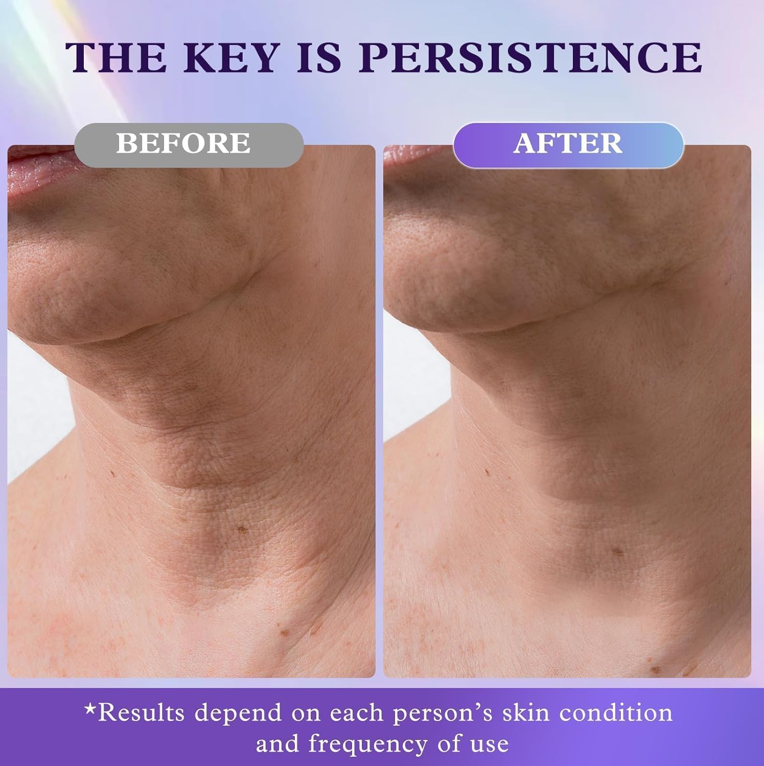 Detalle 2 de UKVOA Retinol Wrinkle Cream for Face & Neck with Collagen, Hyaluronic Acid, 2-Pack