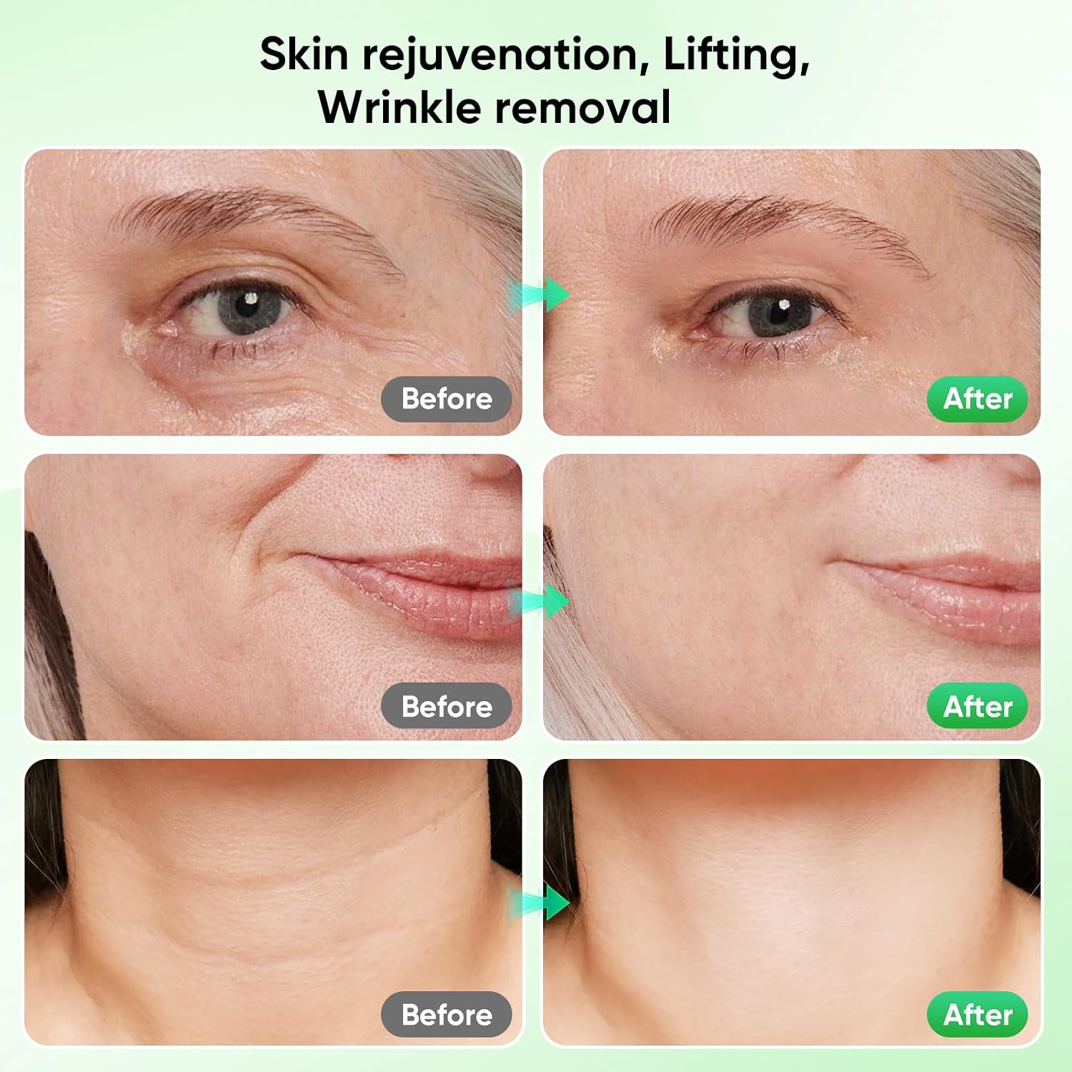 Detalle de Face Massager Facial Device Lift: 6-Mode Skin Tightening with 7-Colour LED and 45°C Heat