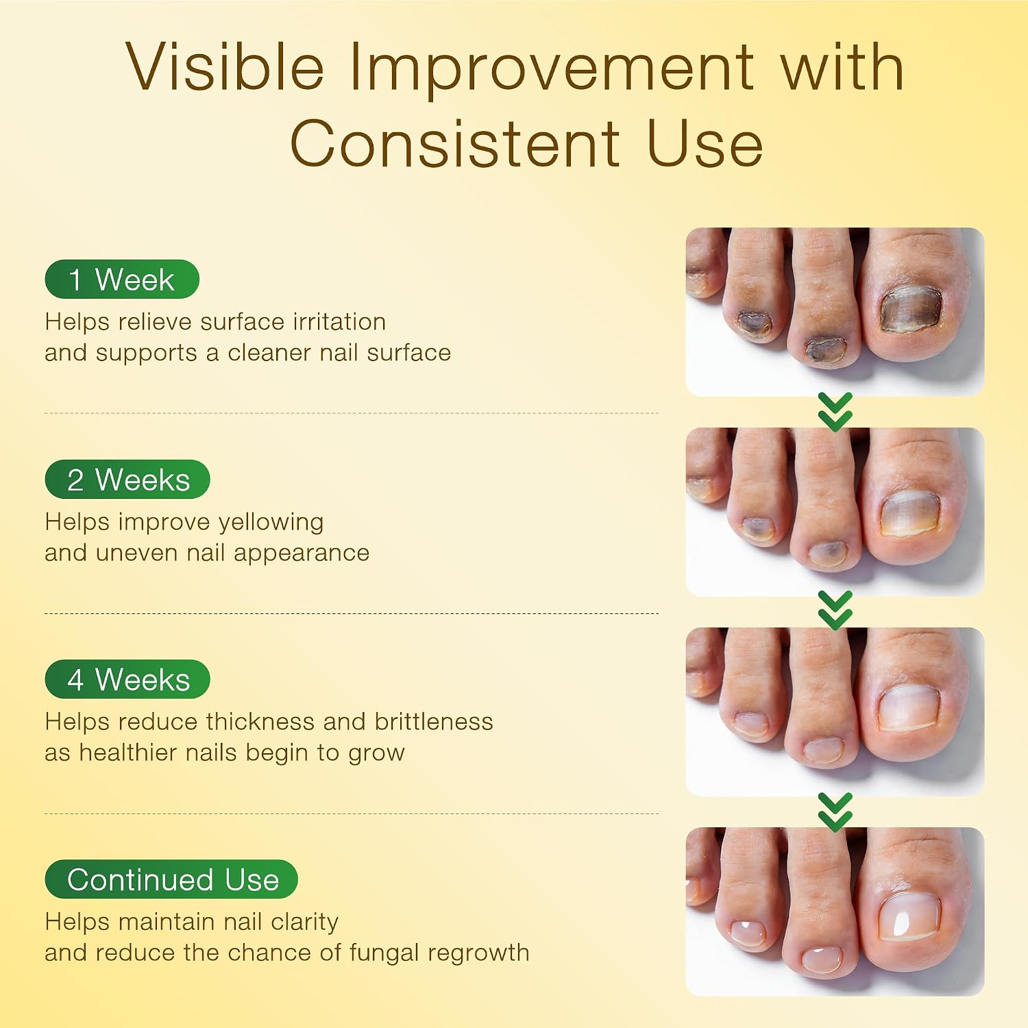 Detalle de SafeFight Toenail Fungus Treatment 30 mL
