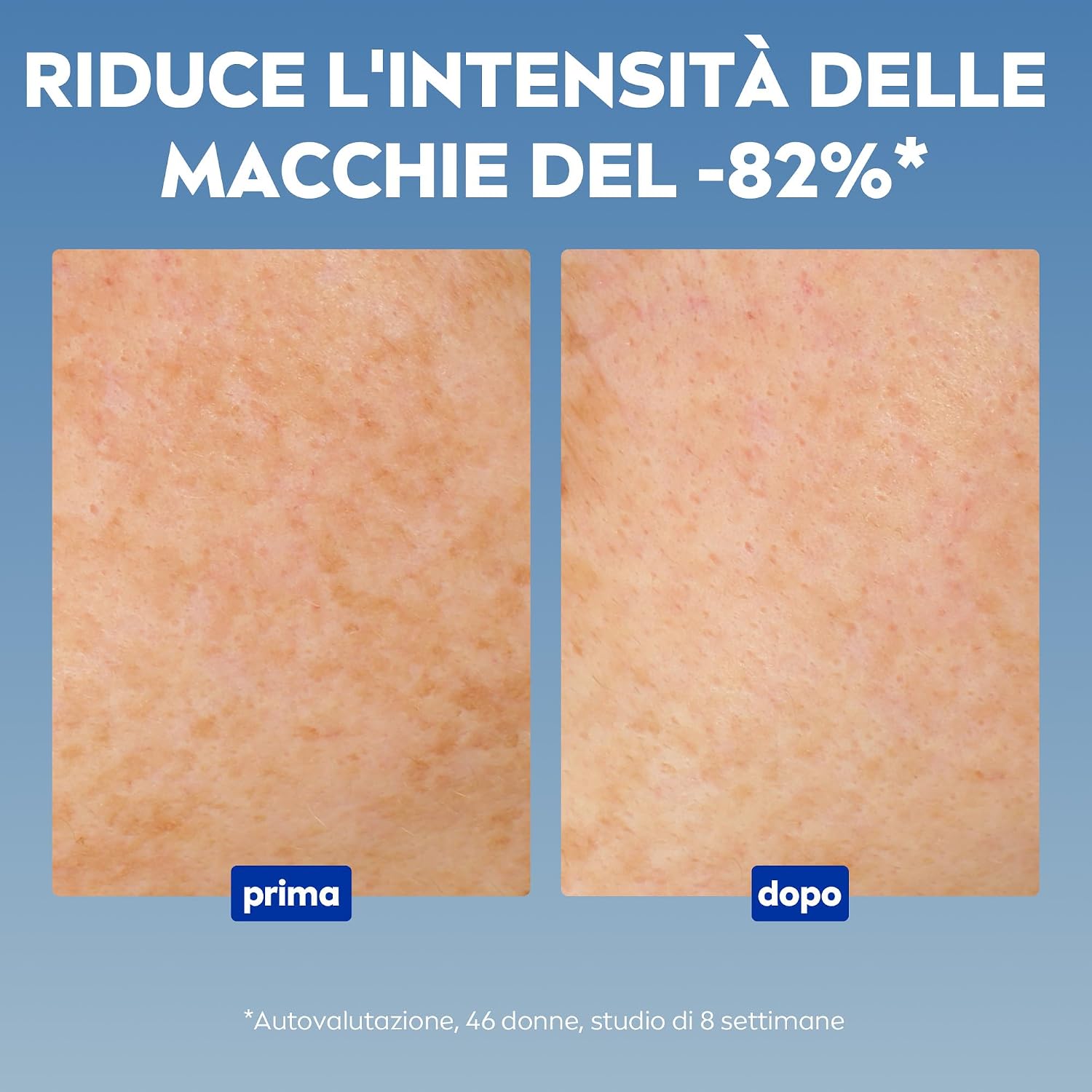 Thumbnail 6 de NIVEA Luminous630 Skin Solution Kit skincare viso: siero anti-macchie, fluido UV SPF 50 e crema notte rigenerante
