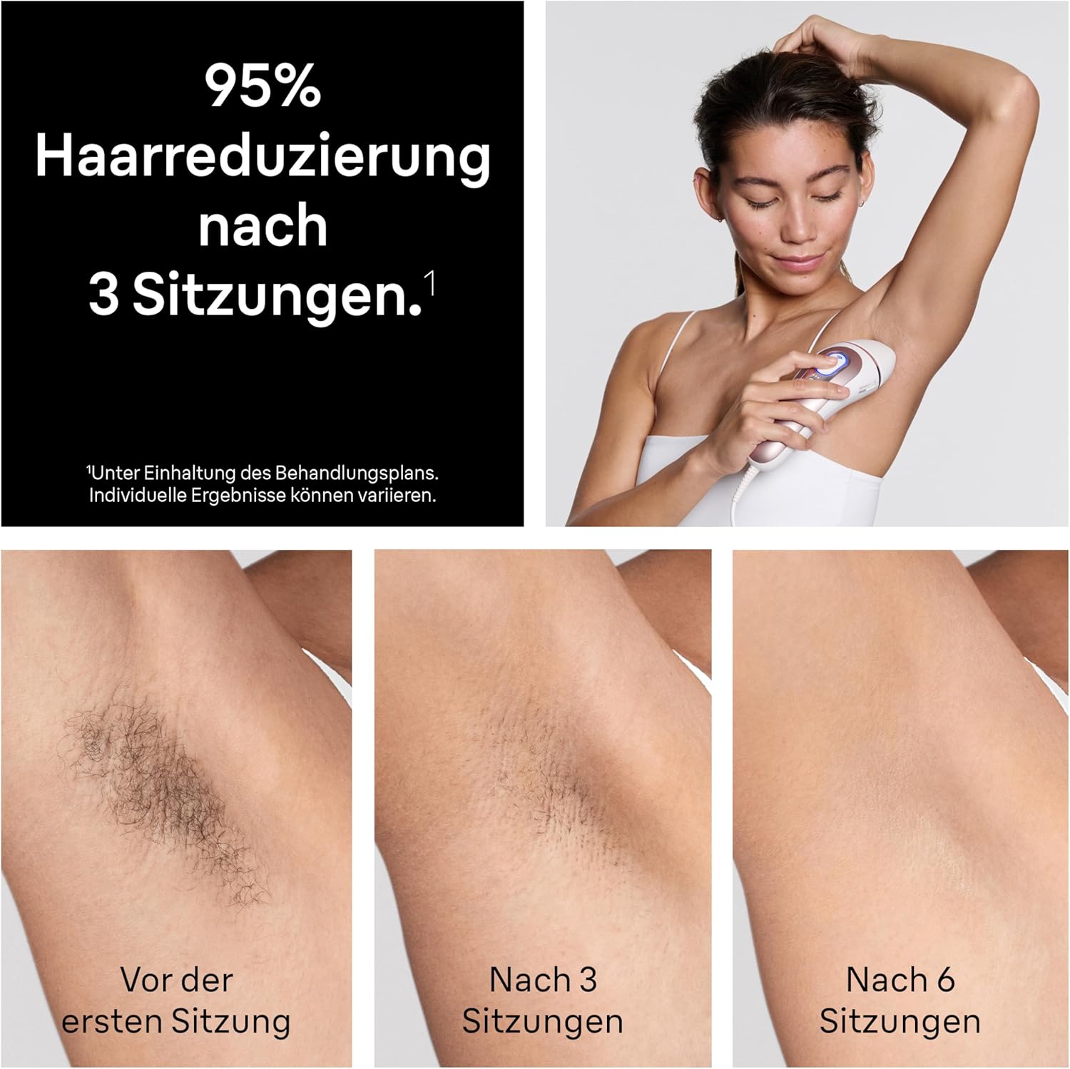 Thumbnail 4 de Braun Smart IPL Geräte Haarentfernung Skin i·expert 7 – Professionelle Dauerhafte Laser Haarentfernung für Zuhause