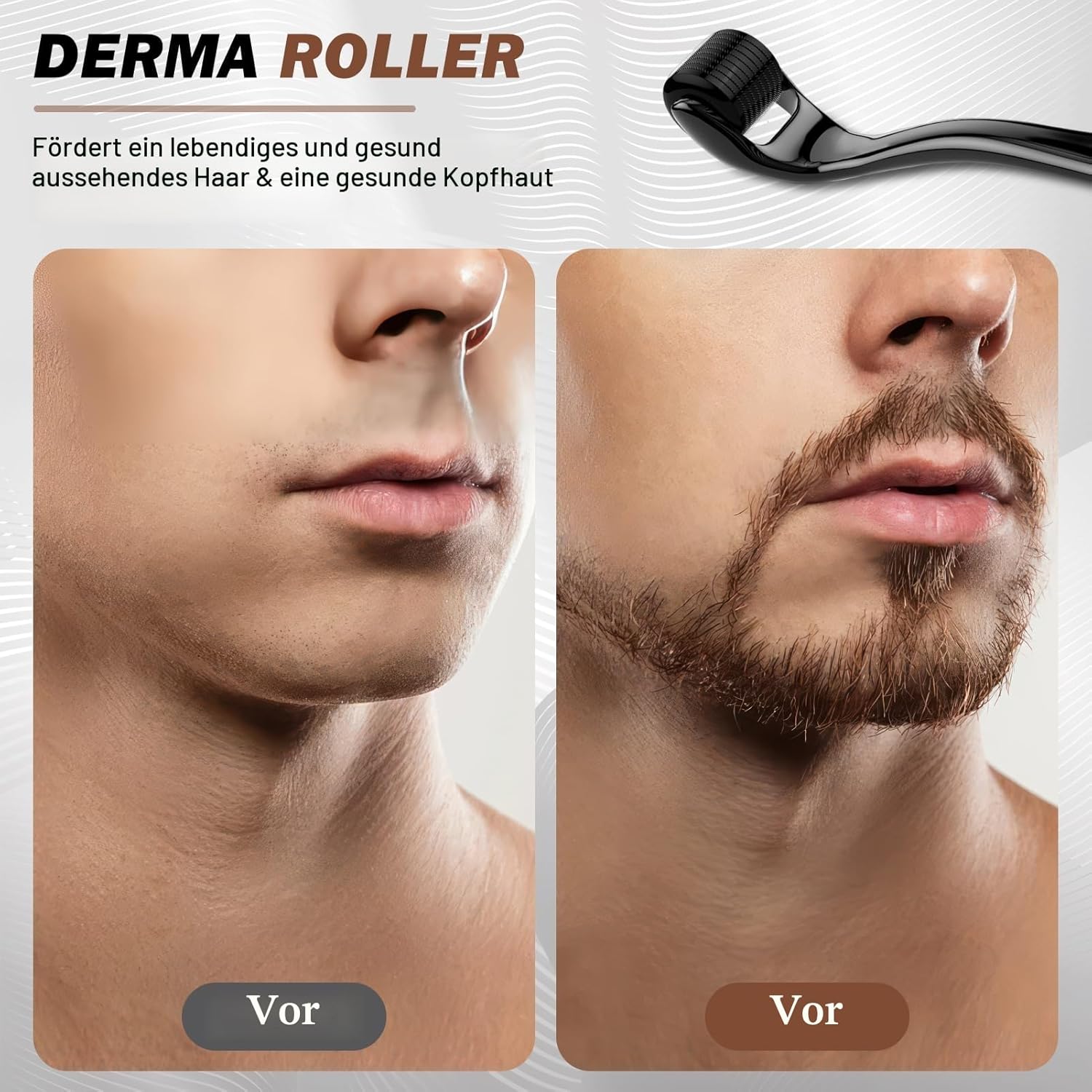 Thumbnail 4 de Bartroller 0,5 mm Derma-roller mit 540 Titan-Nadeln für Bartwuchs