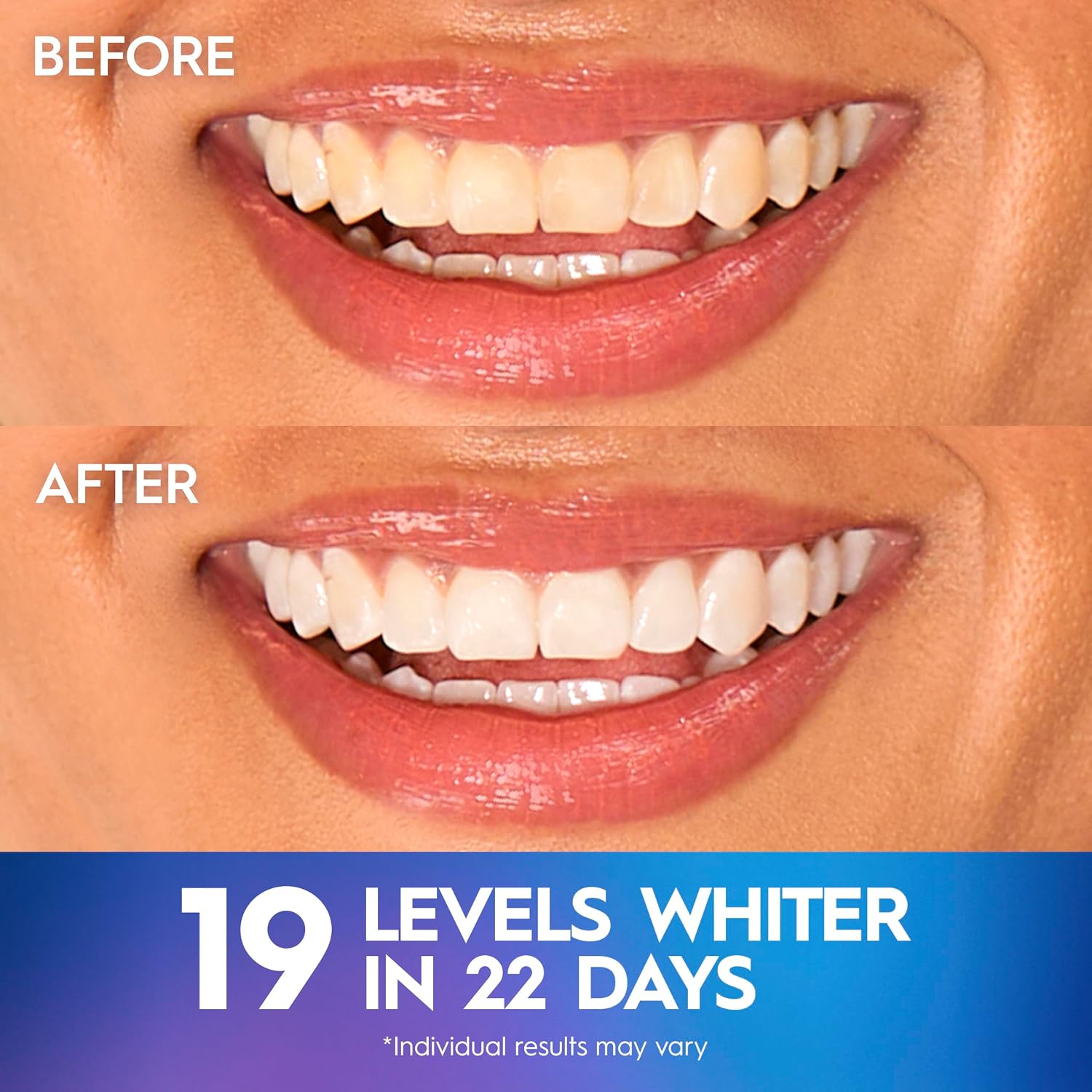 Detalle 2 de Crest 3D White Whitestrips – 2 strips ⚡