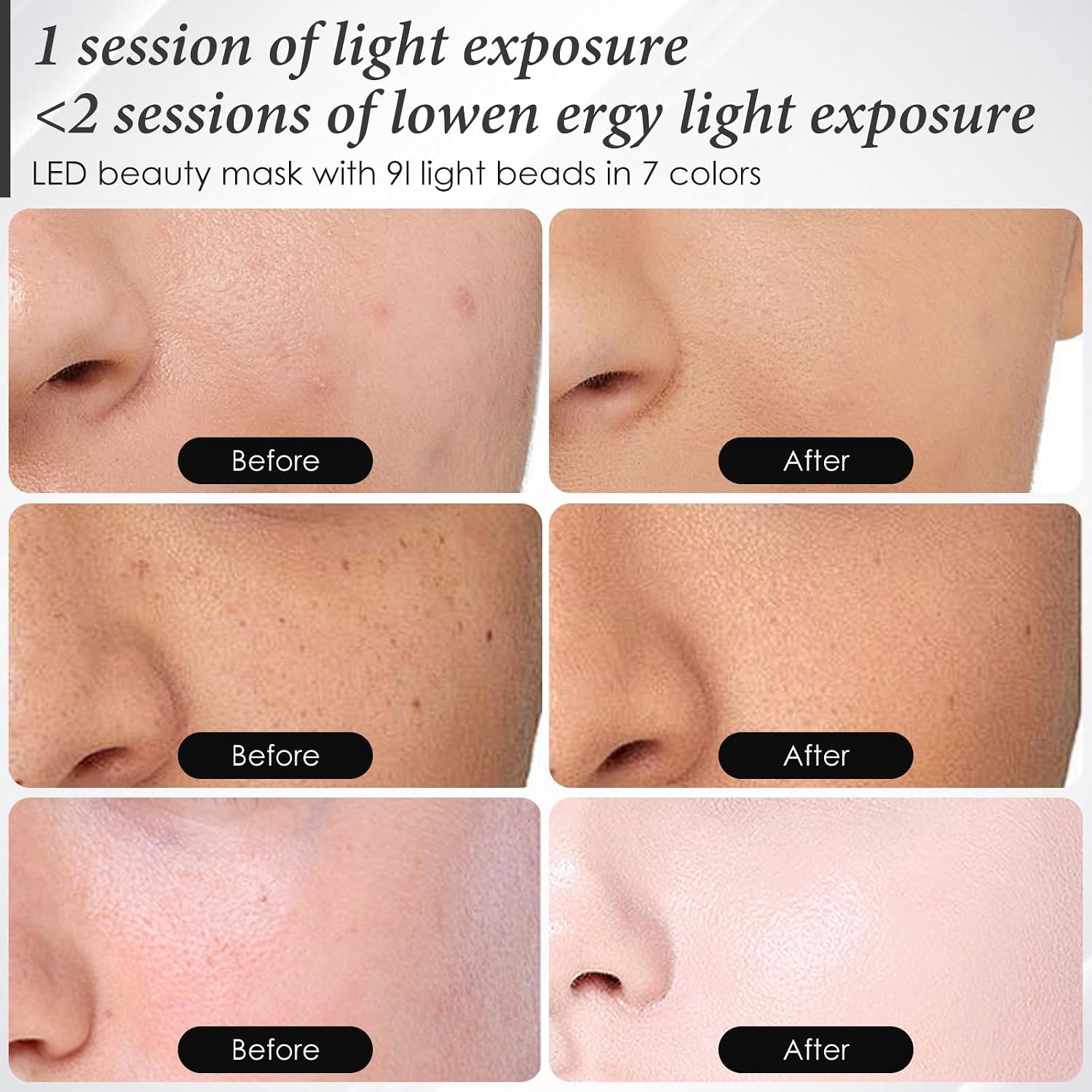 Detalle de SDKWDH Red Light Therapy Mask 850nm