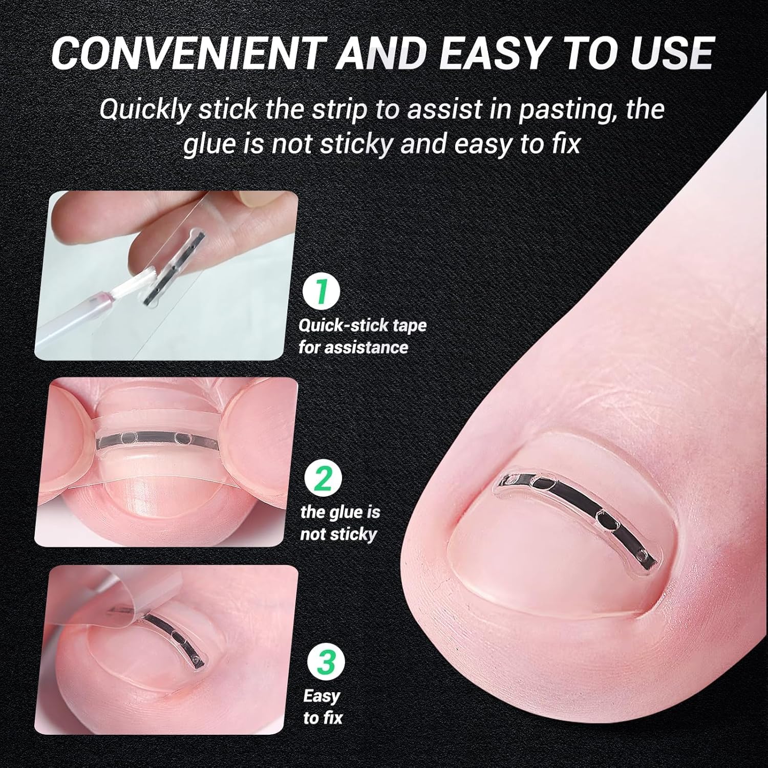 Detalle de Reieset Ingrown Toenail Kit 0.59in