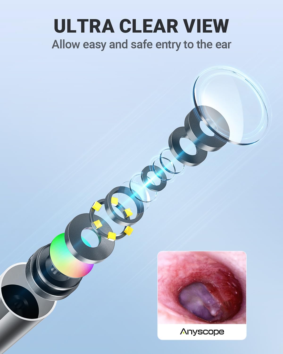 Thumbnail 6 de AnyScope Digital Otoscope for iPhone & Android, 3.9 mm Camera, 6 LEDs